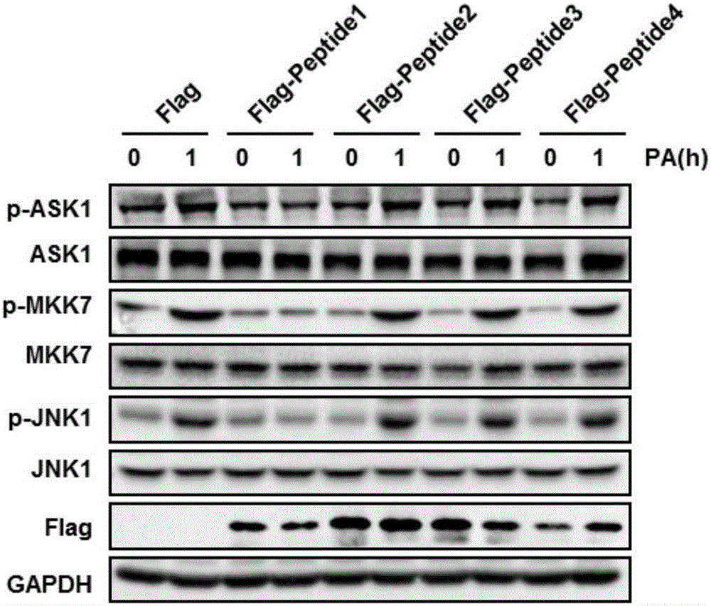 Method for screening drugs for treating steatohepatitis by taking N-terminal dimerization of apoptosis signal-regulating kinase 1 (ASK1) as target