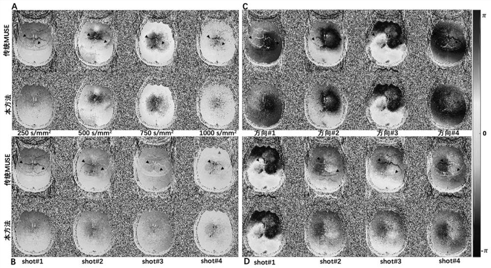 A Multi-Excitation Echo Plane Magnetic Resonance Imaging Method Based on Neural Network