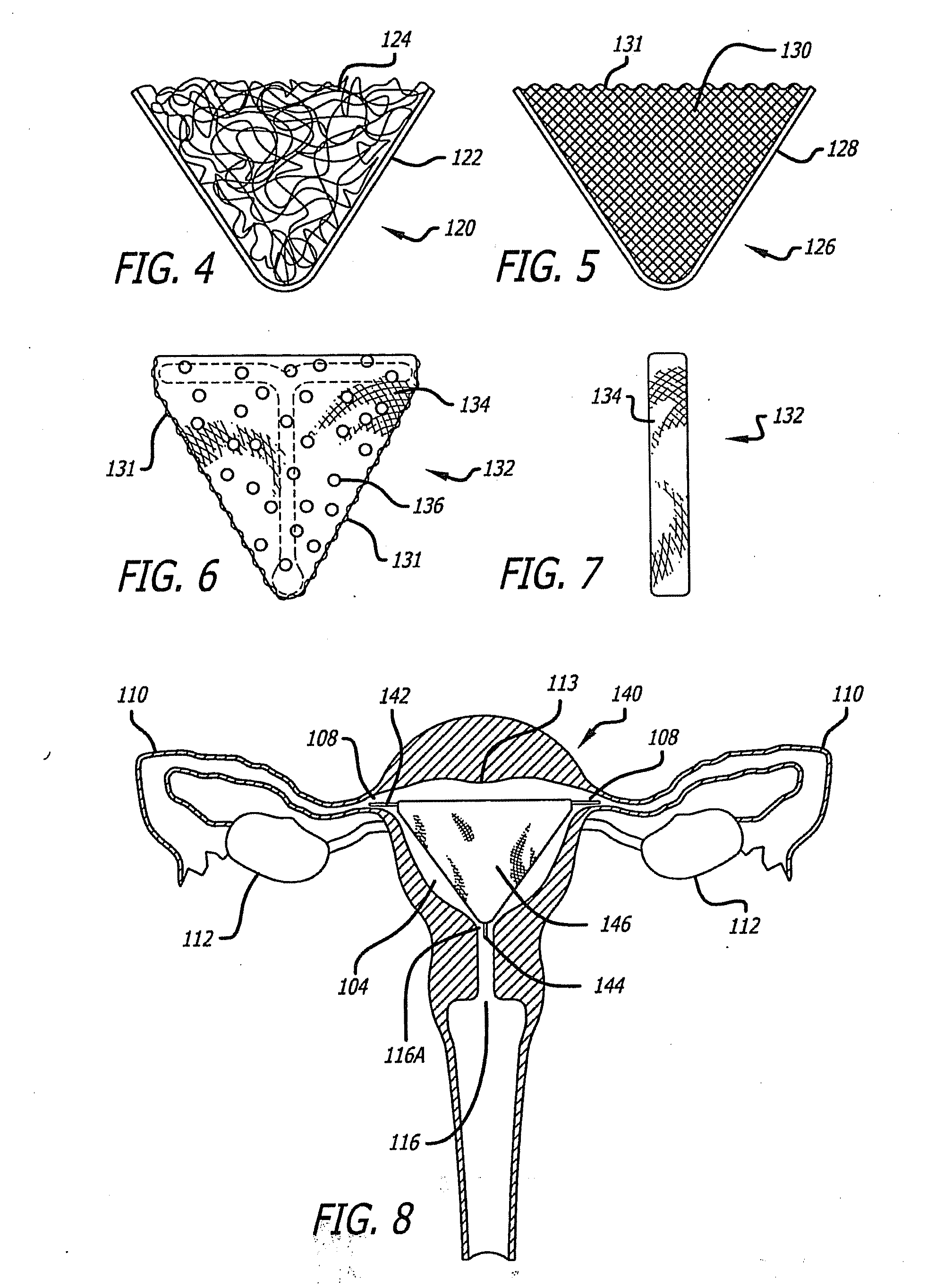 Method and apparatus for creating intrauterine adhesions