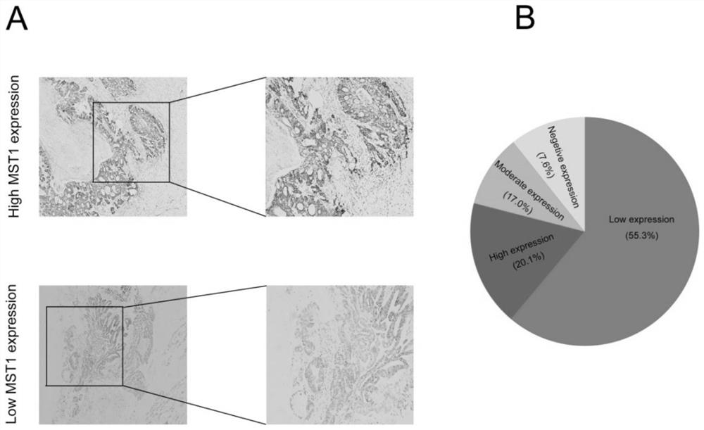 Application of MST1 as drug target in preparation of drug for treating colorectal cancer