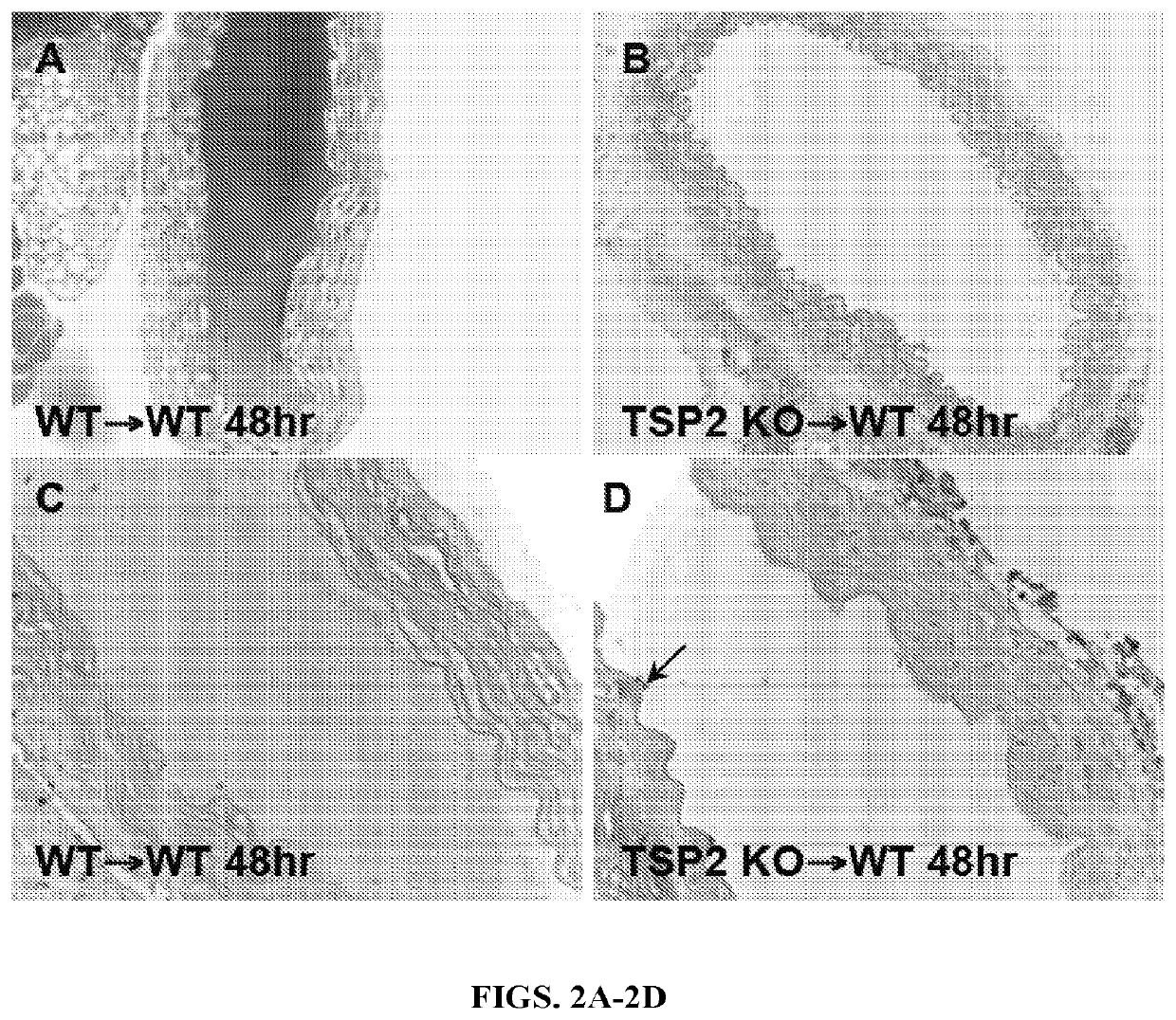 Compositions and methods for grafts modified with a non-thrombogenic and pro-migratory cell-derived extracellular matrix