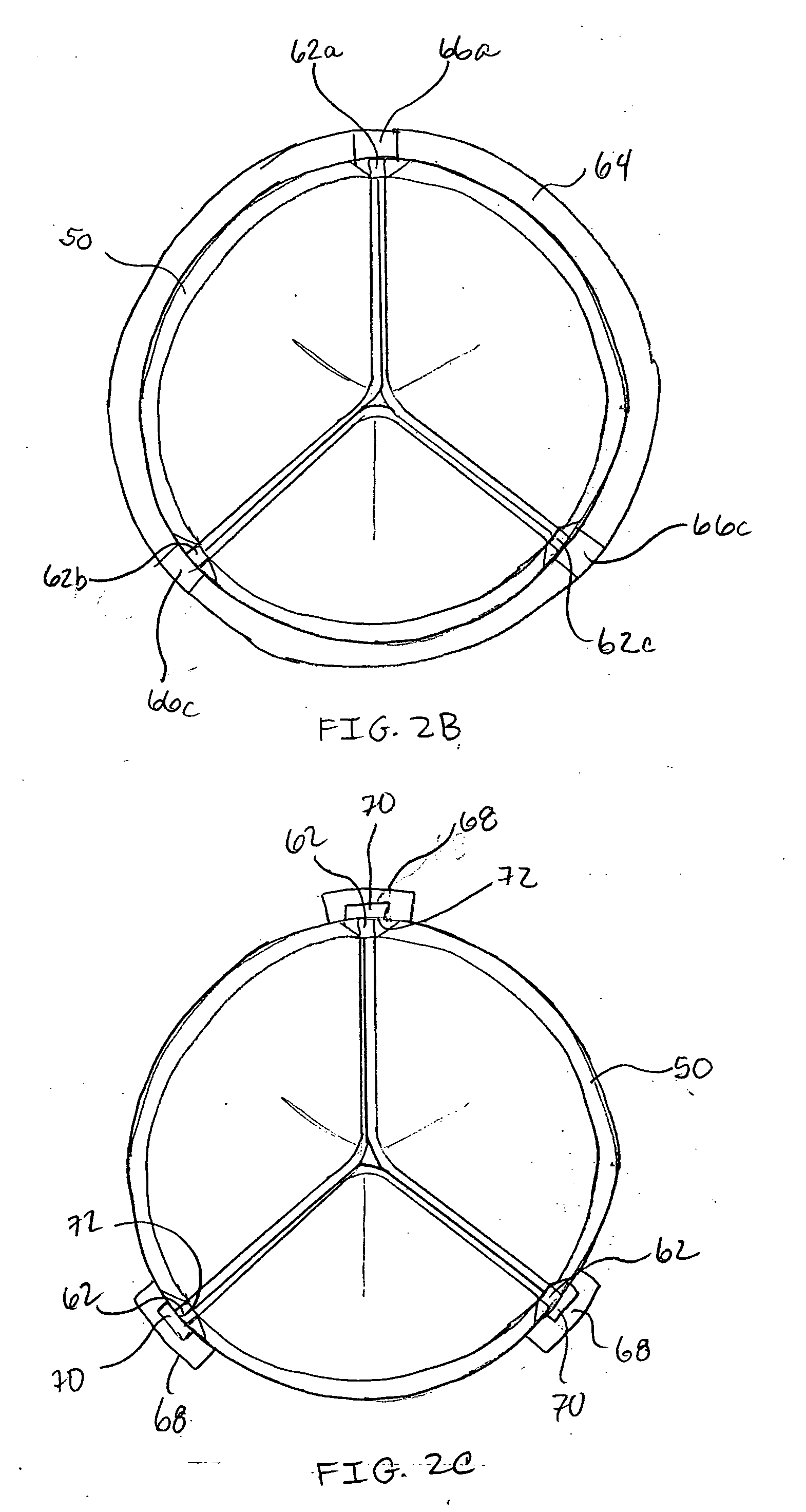 Prosthetic cardiac valves and systems and methods for implanting thereof