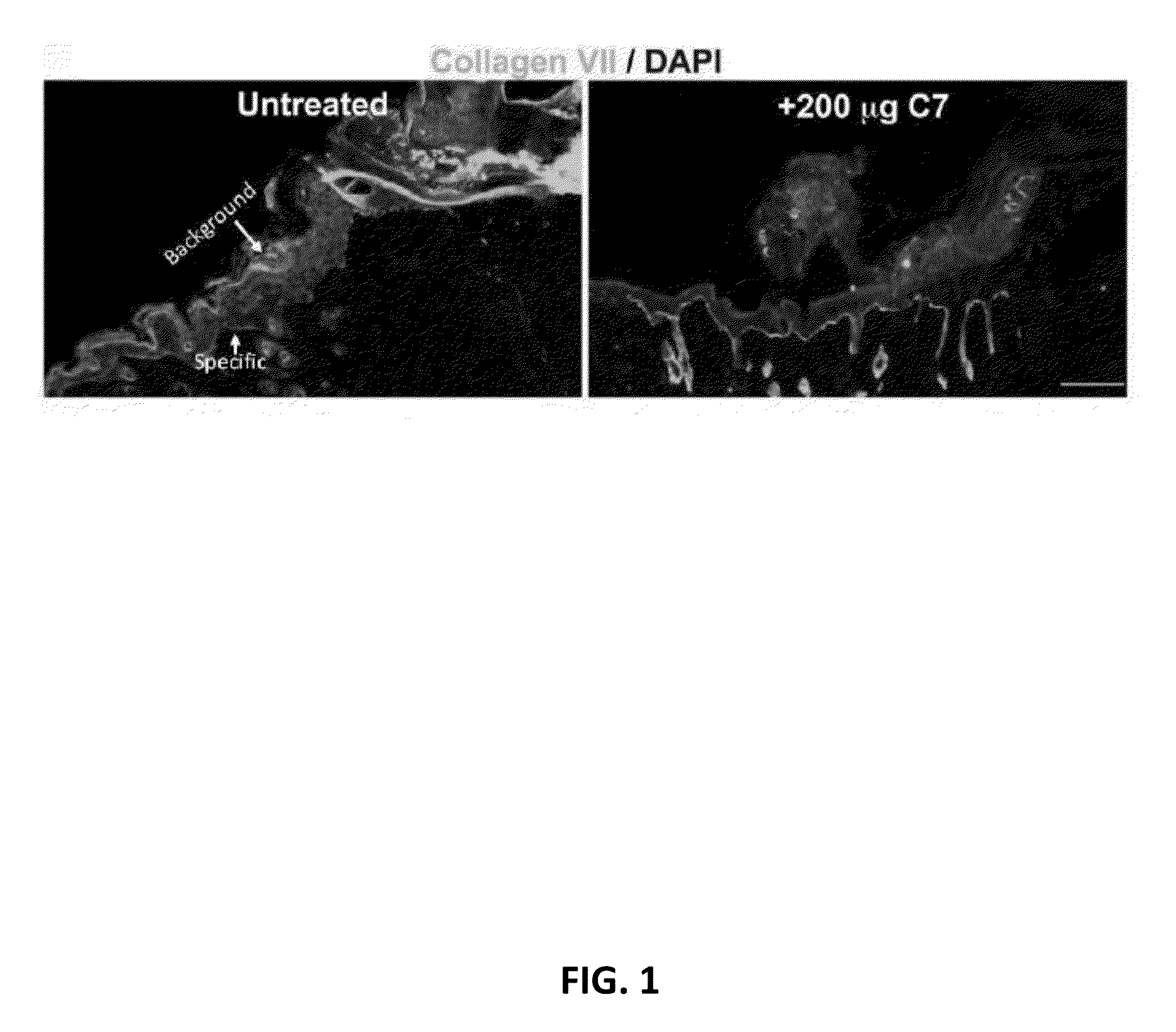 Recombinant C7 and Methods of Use