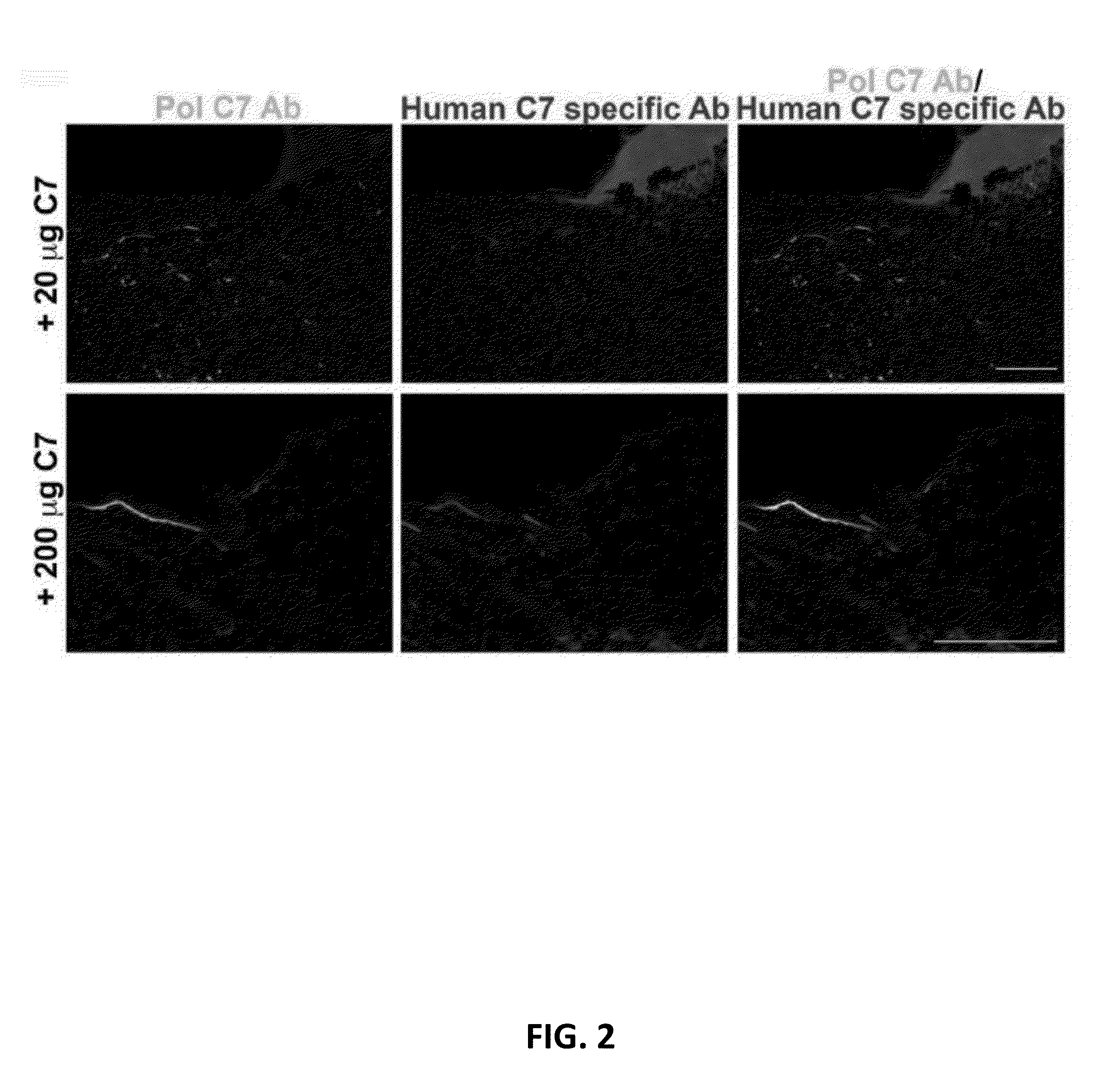 Recombinant C7 and Methods of Use