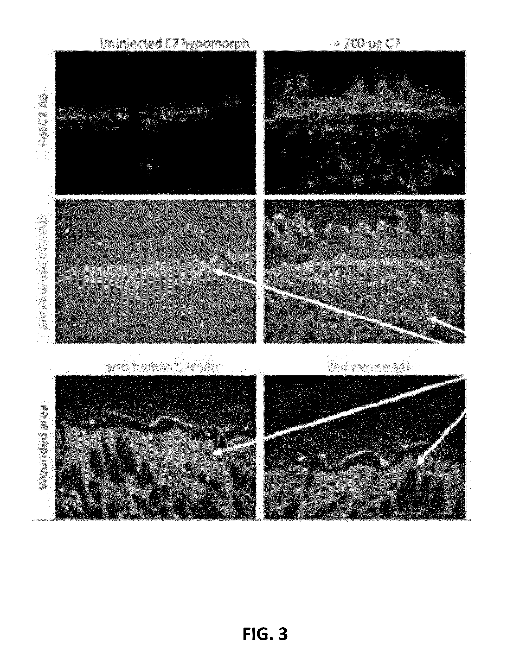 Recombinant C7 and Methods of Use