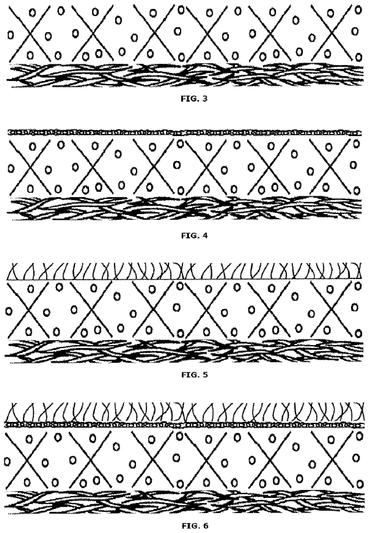 Absorbent structure comprising release structure