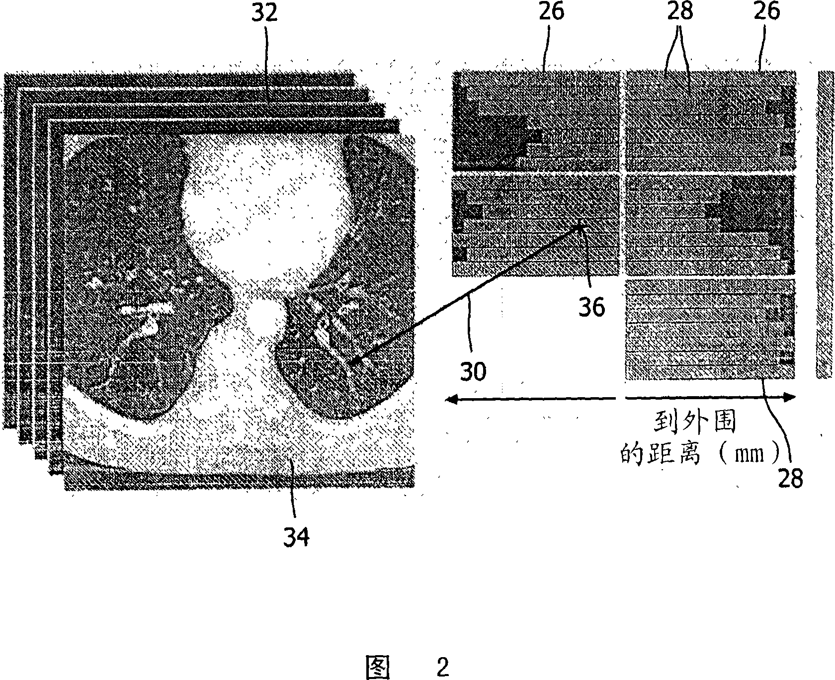 Apparatus and method for providing 2D representation of 3D image data representing an anatomical lumen tree structure