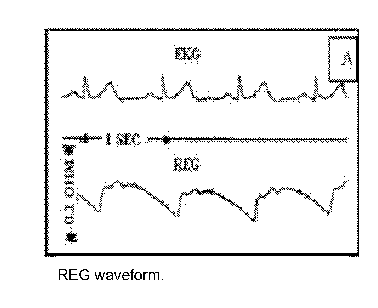 Method and Apparatus For Non-Invasive Assessment of Hemodynamic and Functional State of the Brain