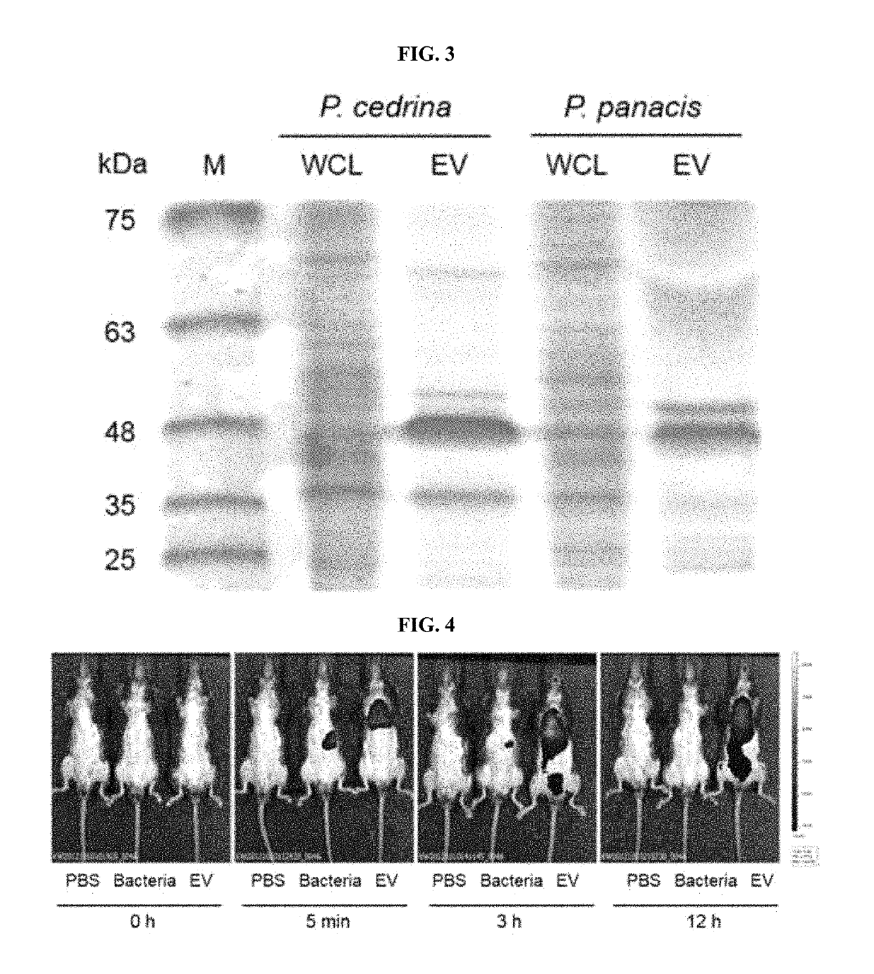 Method of treating an inflammatory disease using lactic acid bacteria-derived extracellular vesicles