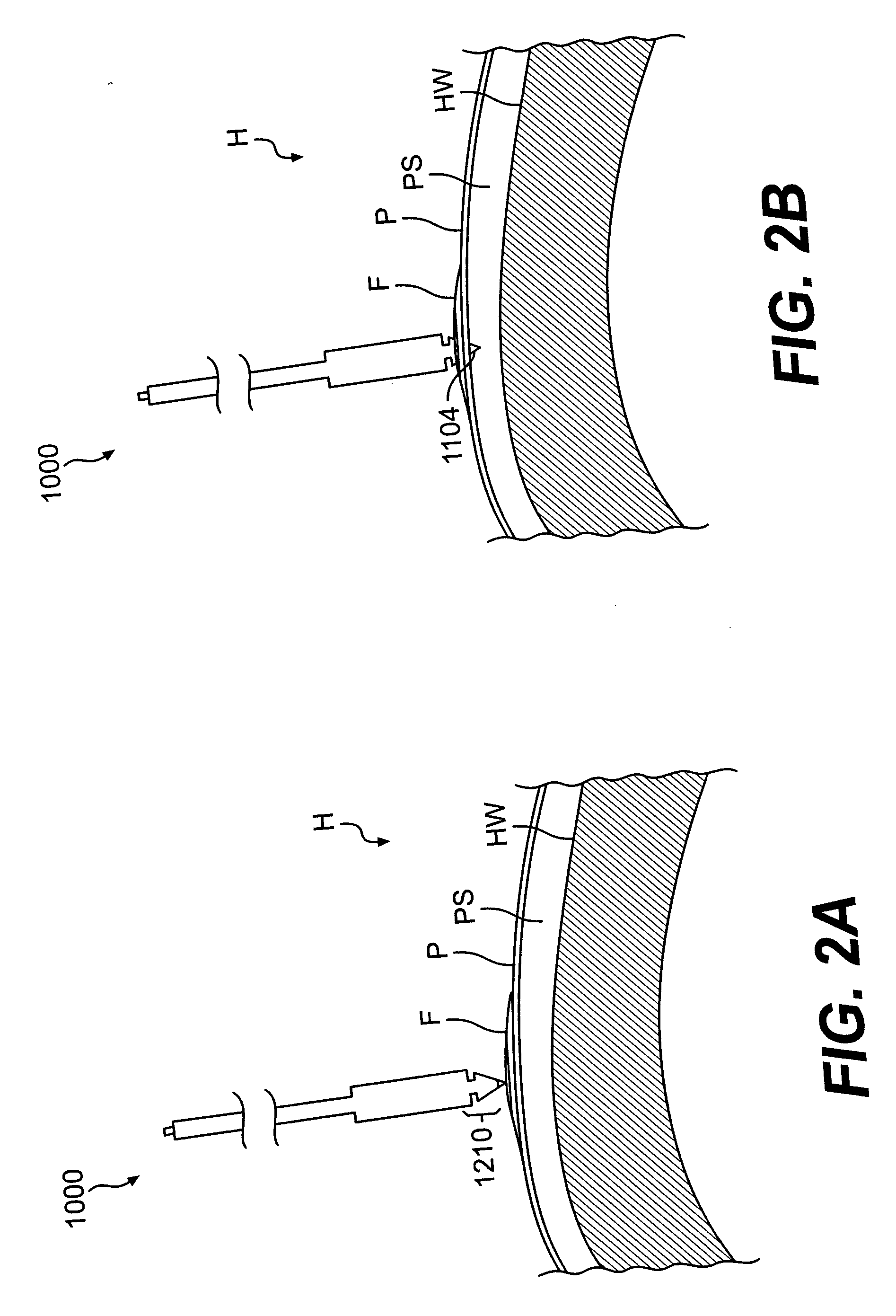 Devices and methods for pericardial access
