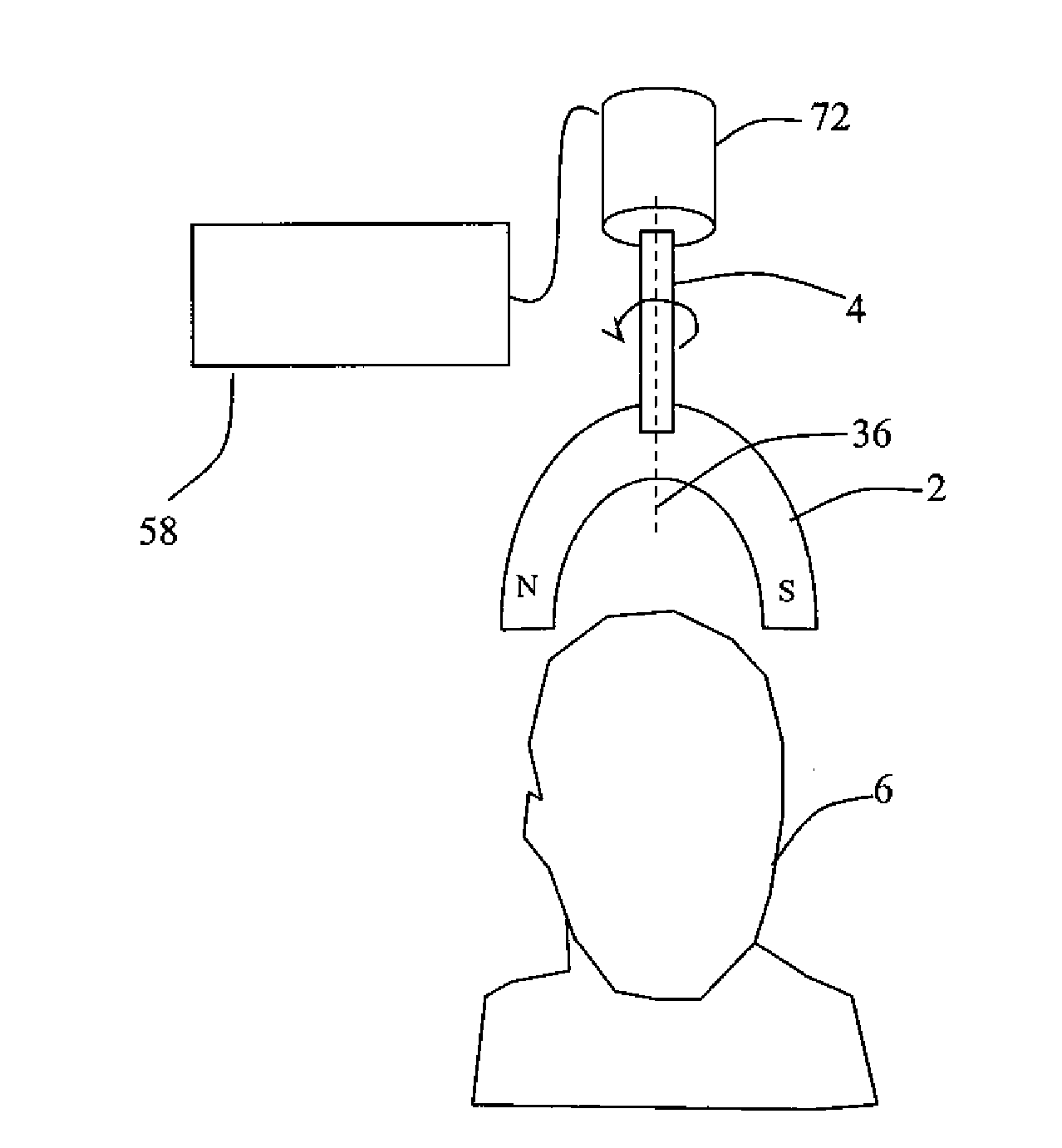 Systems and Methods for Anxiety Treatment Using Neuro-EEG Synchronization Therapy
