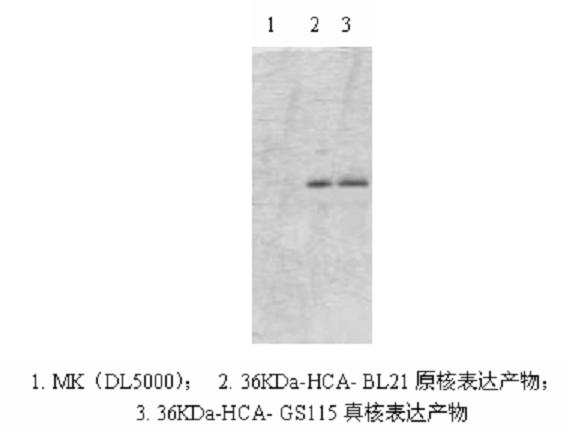 Agkistrodon acutus hemocoagulase gene and methods for preparing expression vector, host cell and recombinant protein thereof
