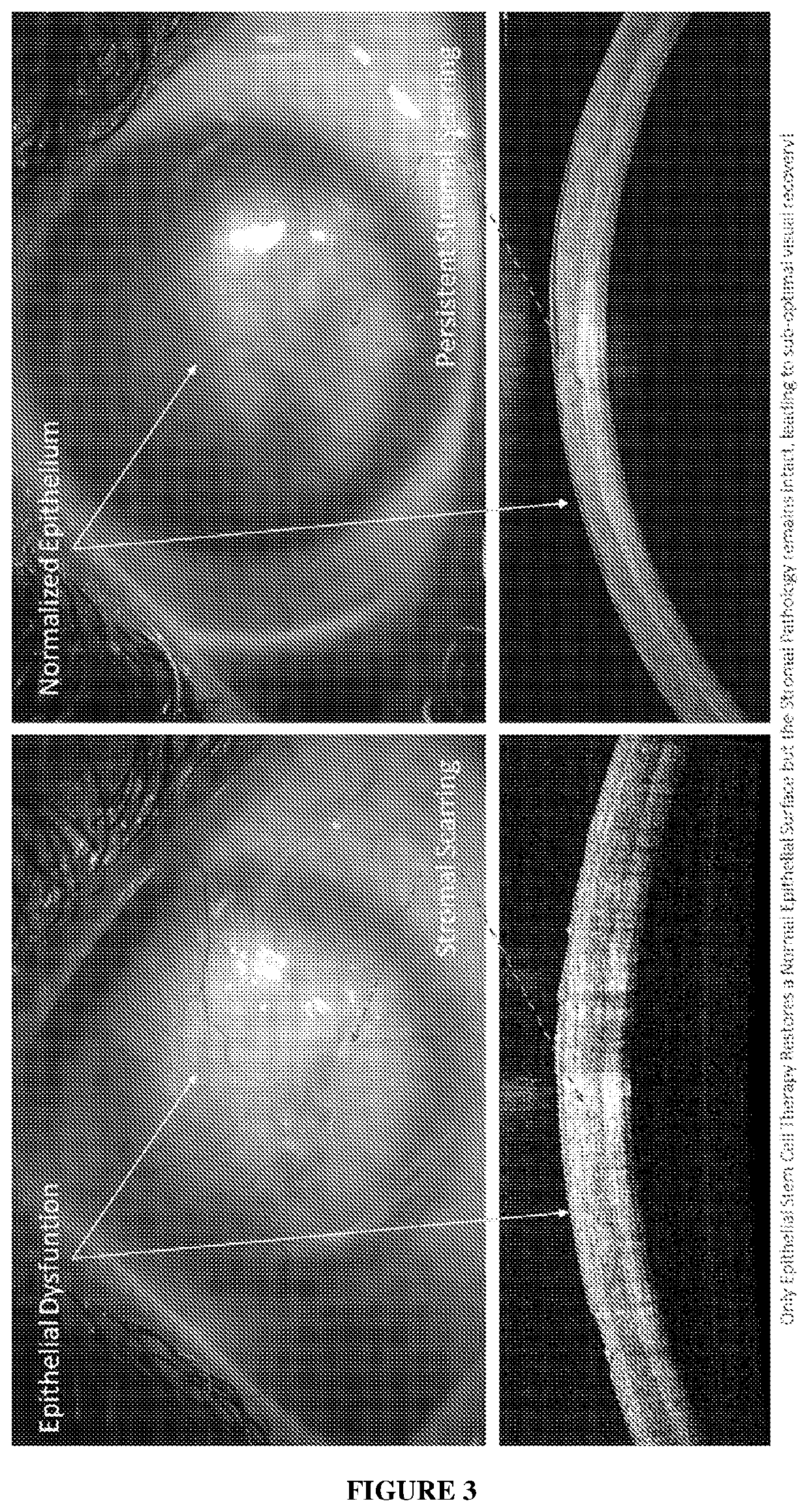 Cell Composition, Method of Production and its Use in Corneal Diseases