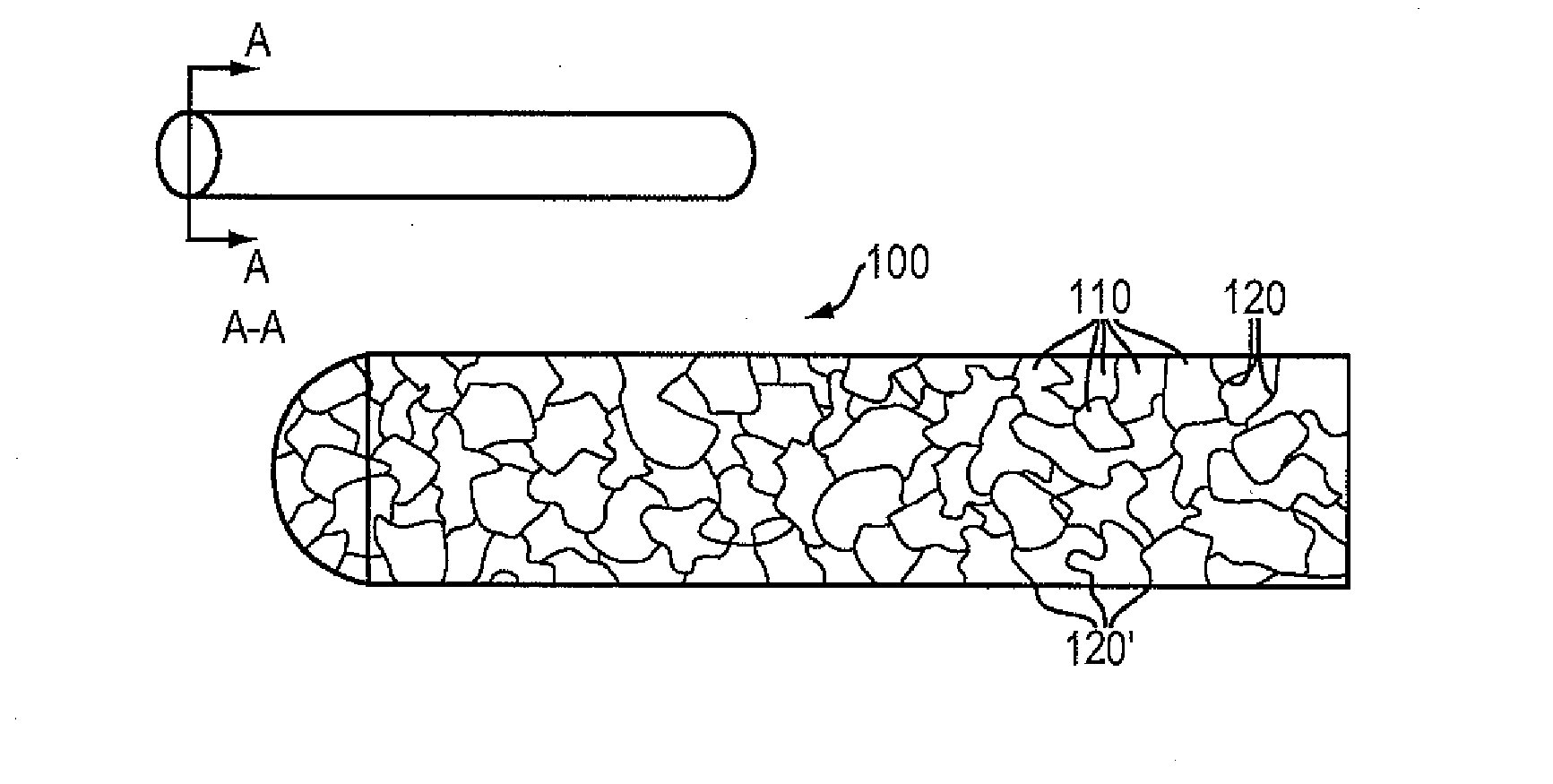 Magnesium-Based Absorbable Implants
