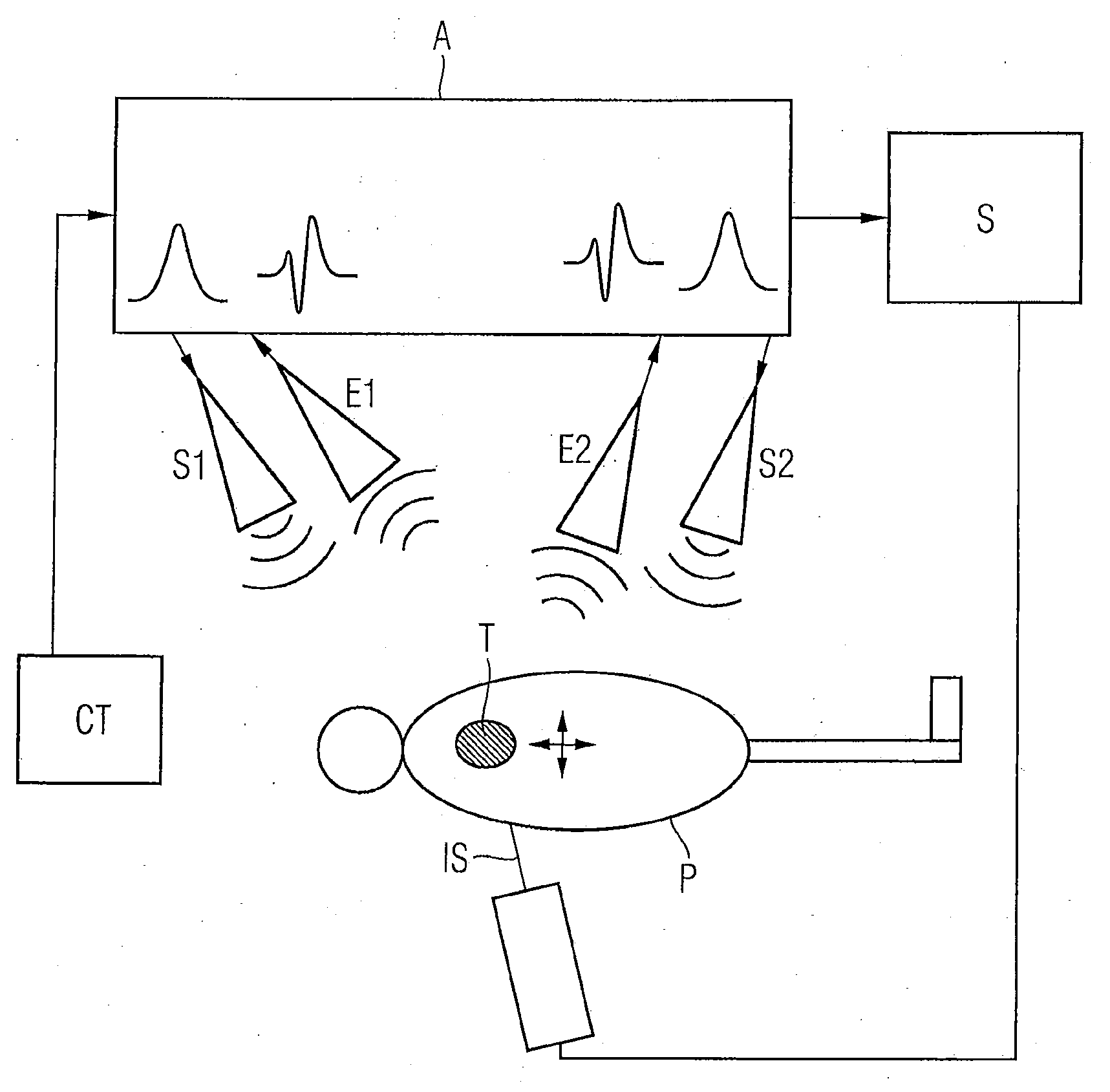 movement-detection-during-radiation-treatment-using-a-radar-system