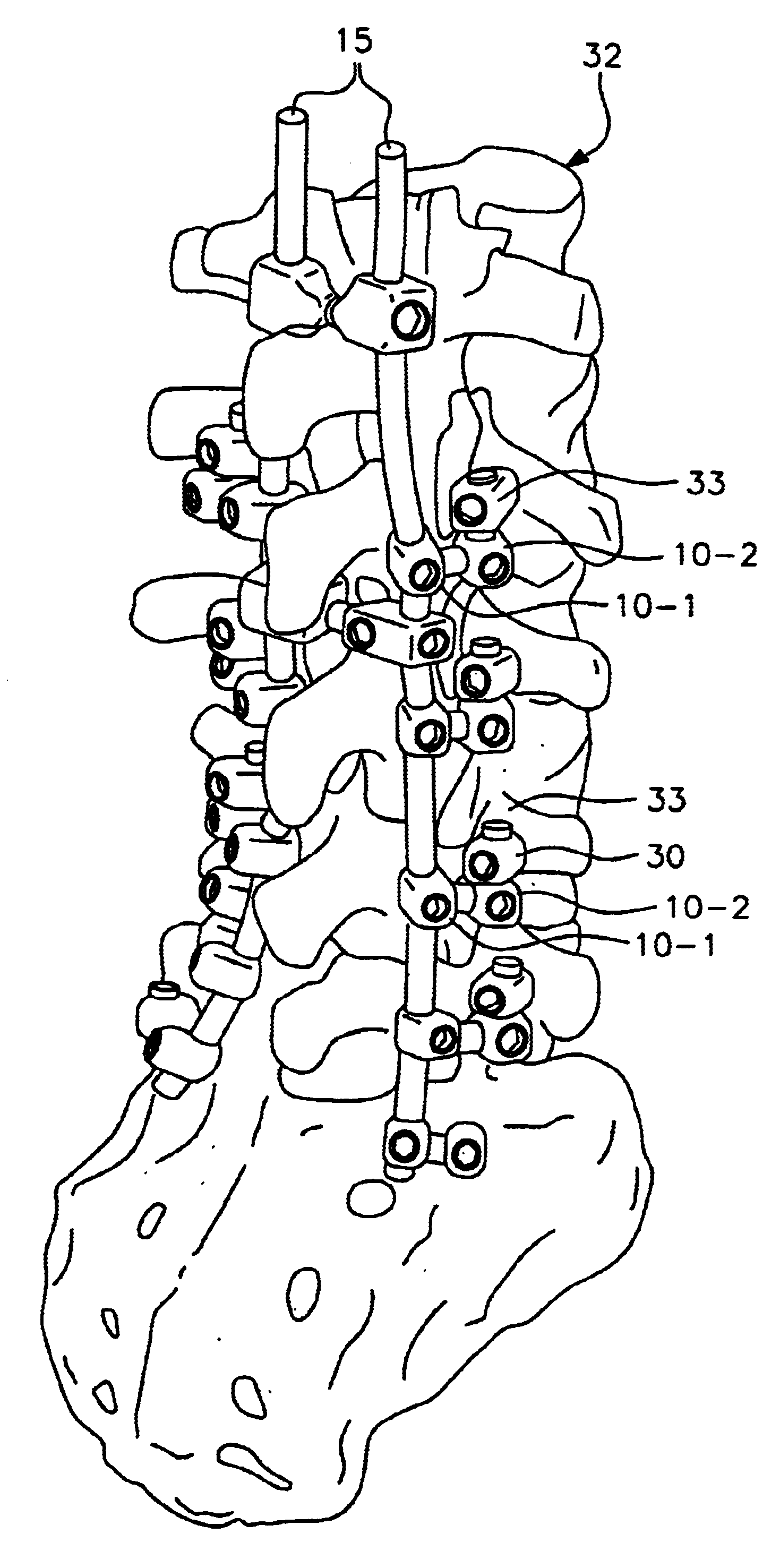 Spinal-rod connecting apparatus and a connector thereof