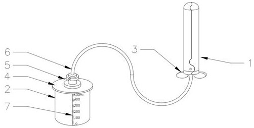 Novel cervical cancer vaginal syringe