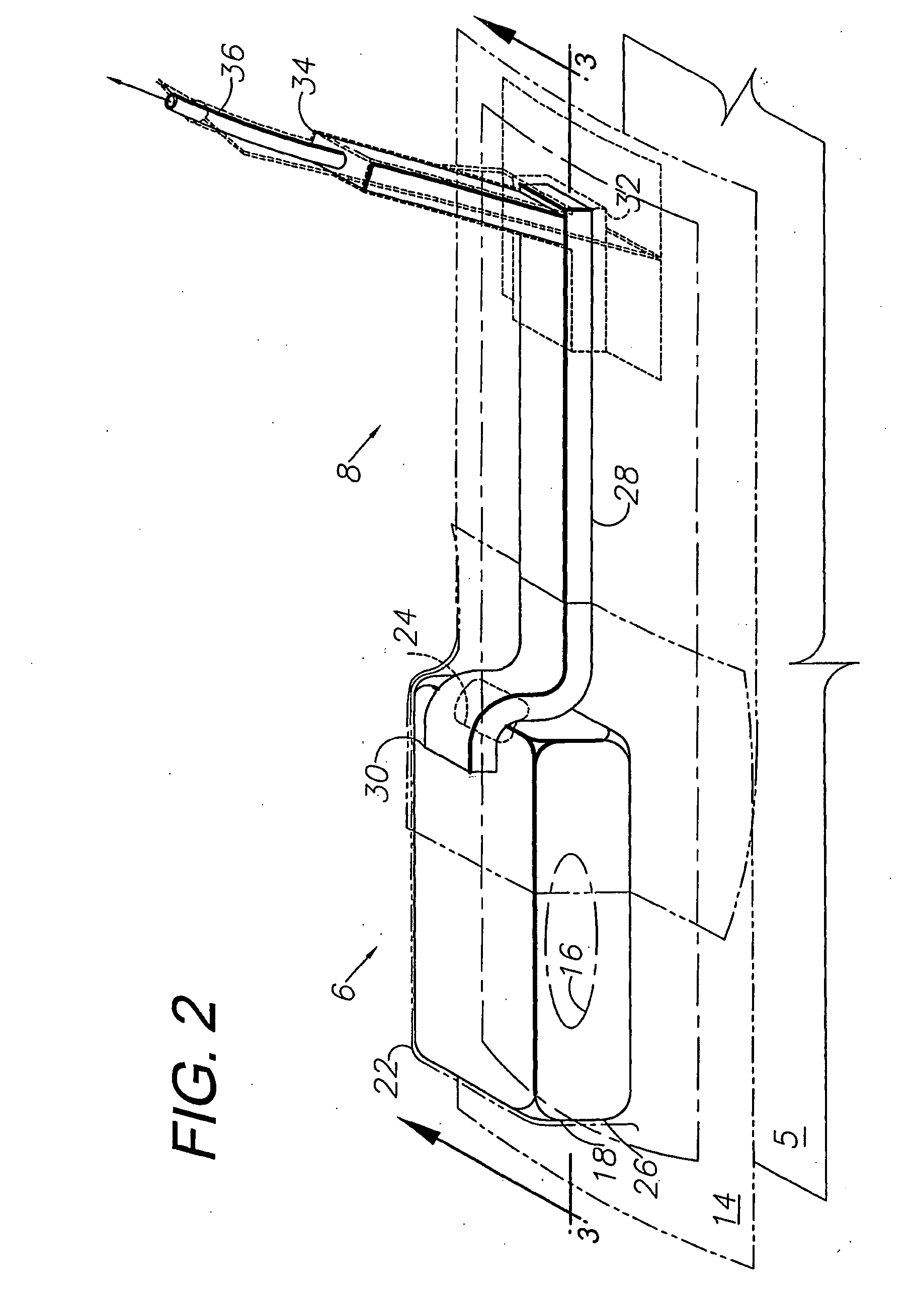 Gradient wound treatment system and method
