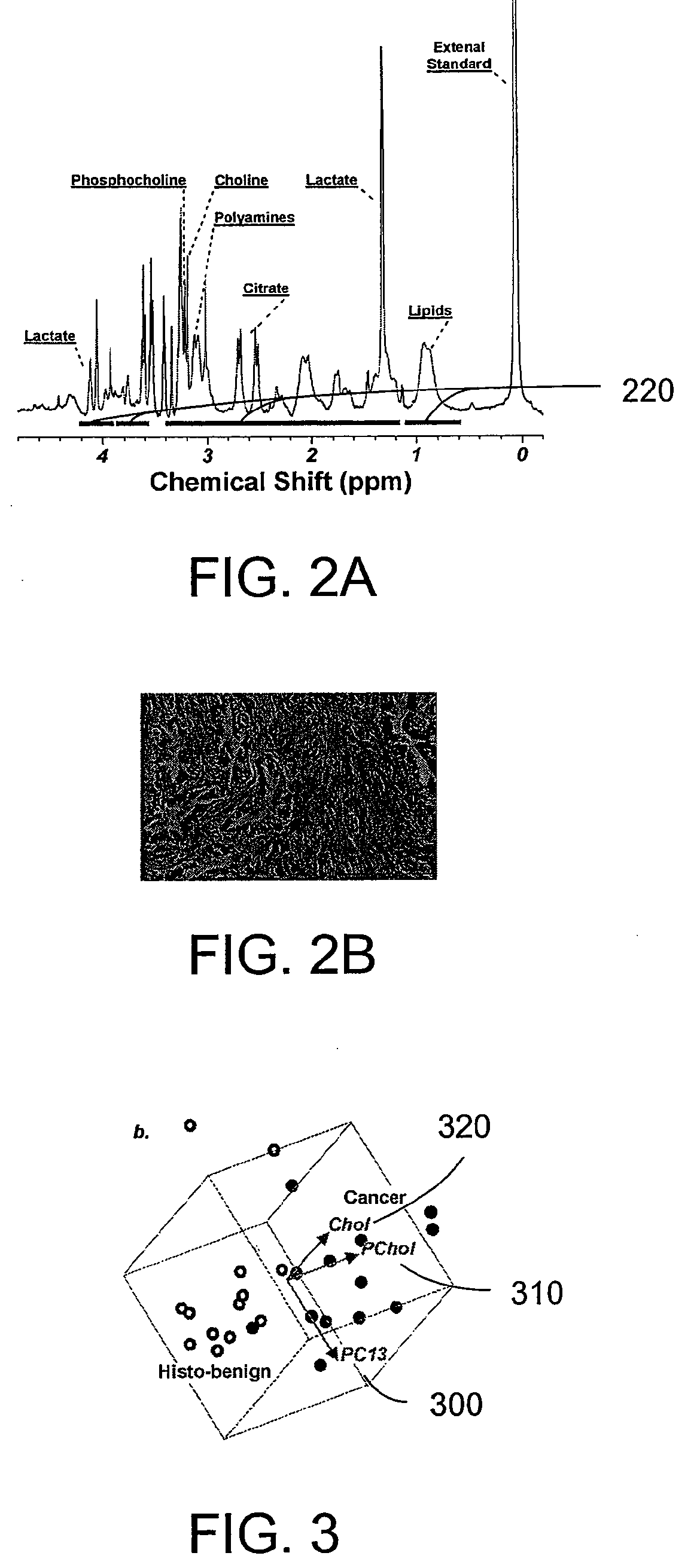 System, method and software arrangement for analyzing and correlating molecular profiles associated with anatomical structures
