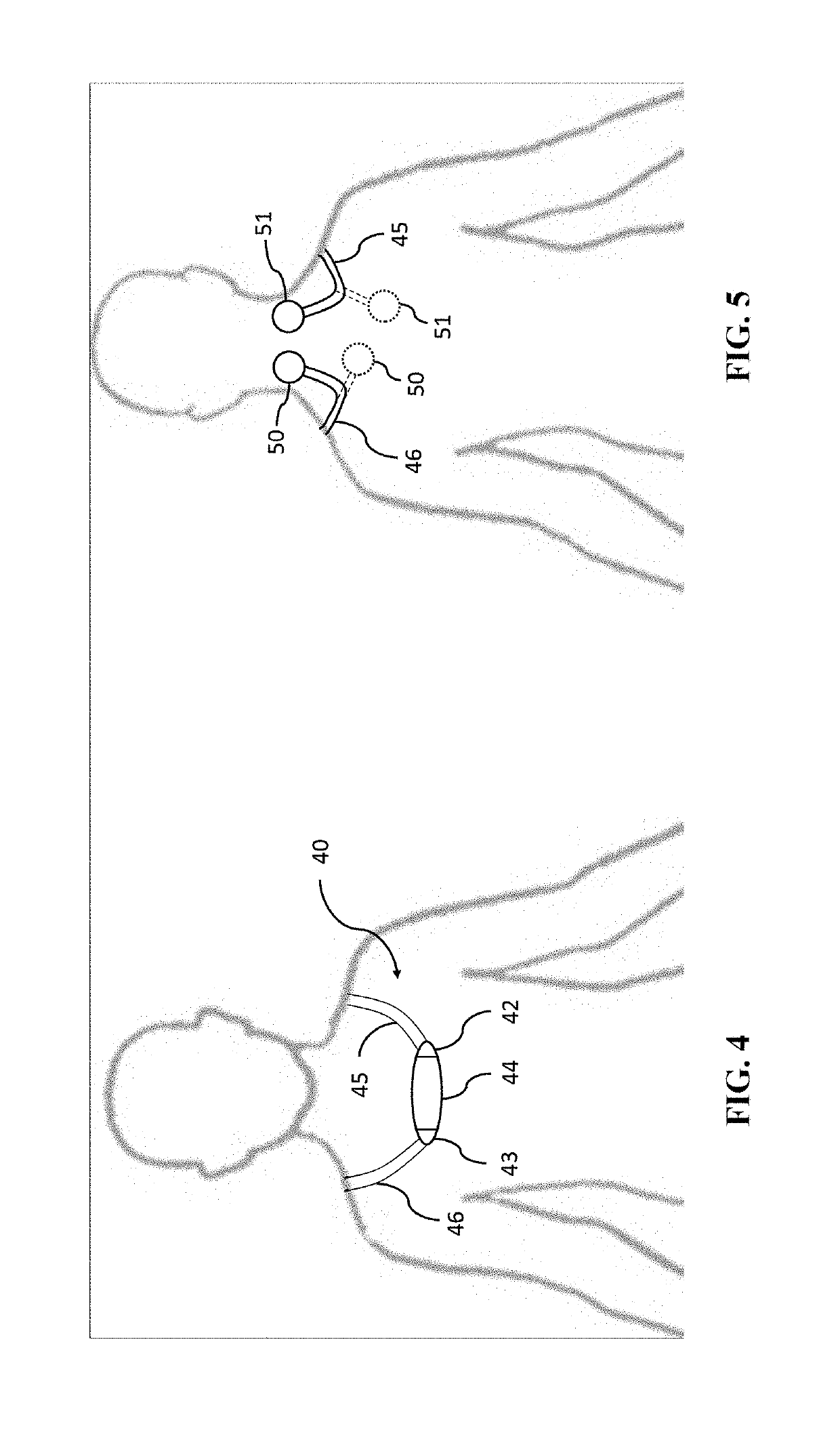 Ultrasonic hearing system and related methods