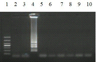 Detection kit used for detecting echinococcus shiquicus (larvae)