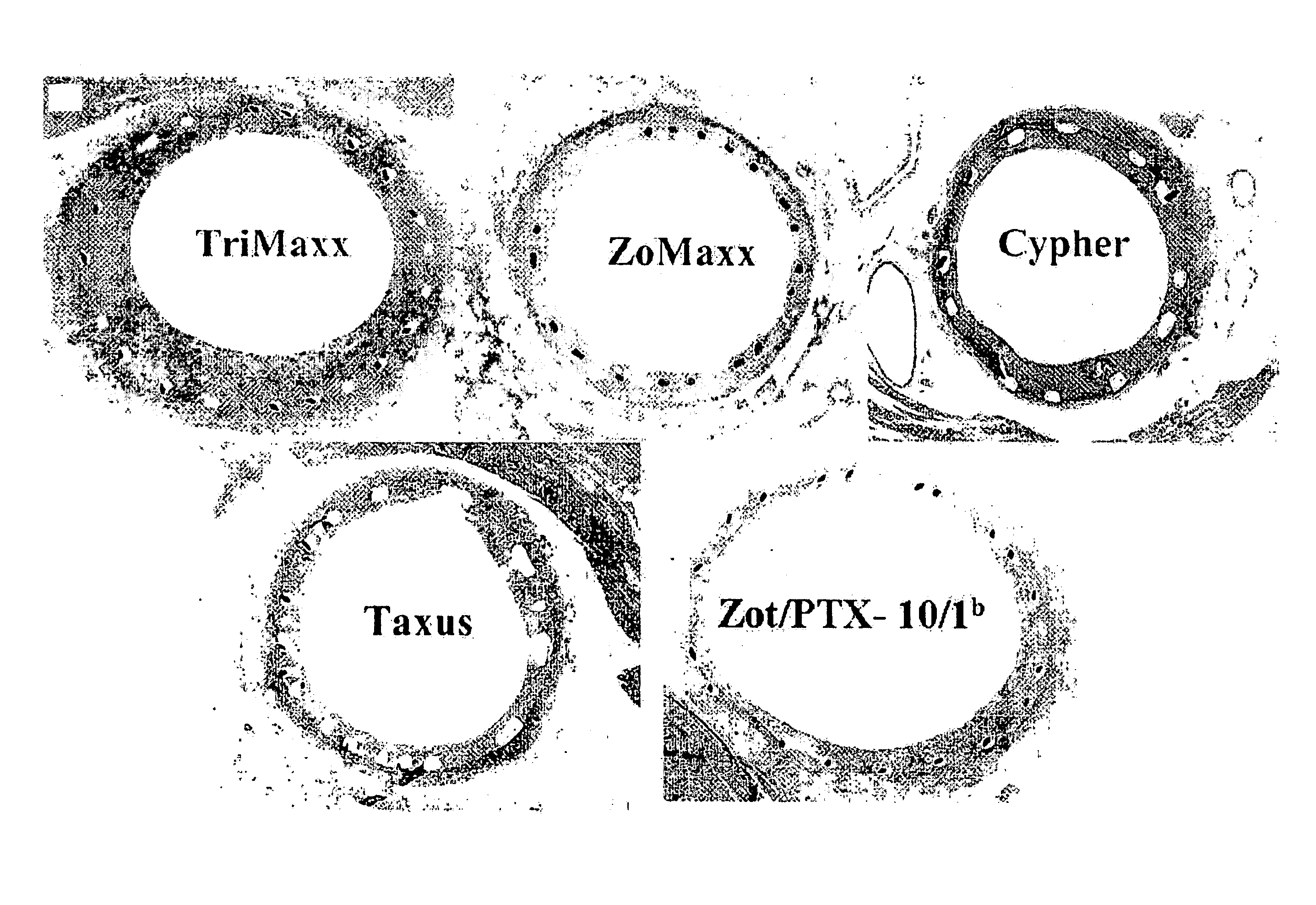 Method Of Treating Disorders Using Compositions Comprising Zotarolimus And Paclitaxel