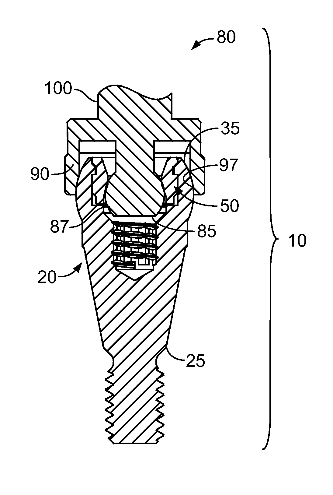 Fixed detachable dental attachment device, assembly and methods of using the same