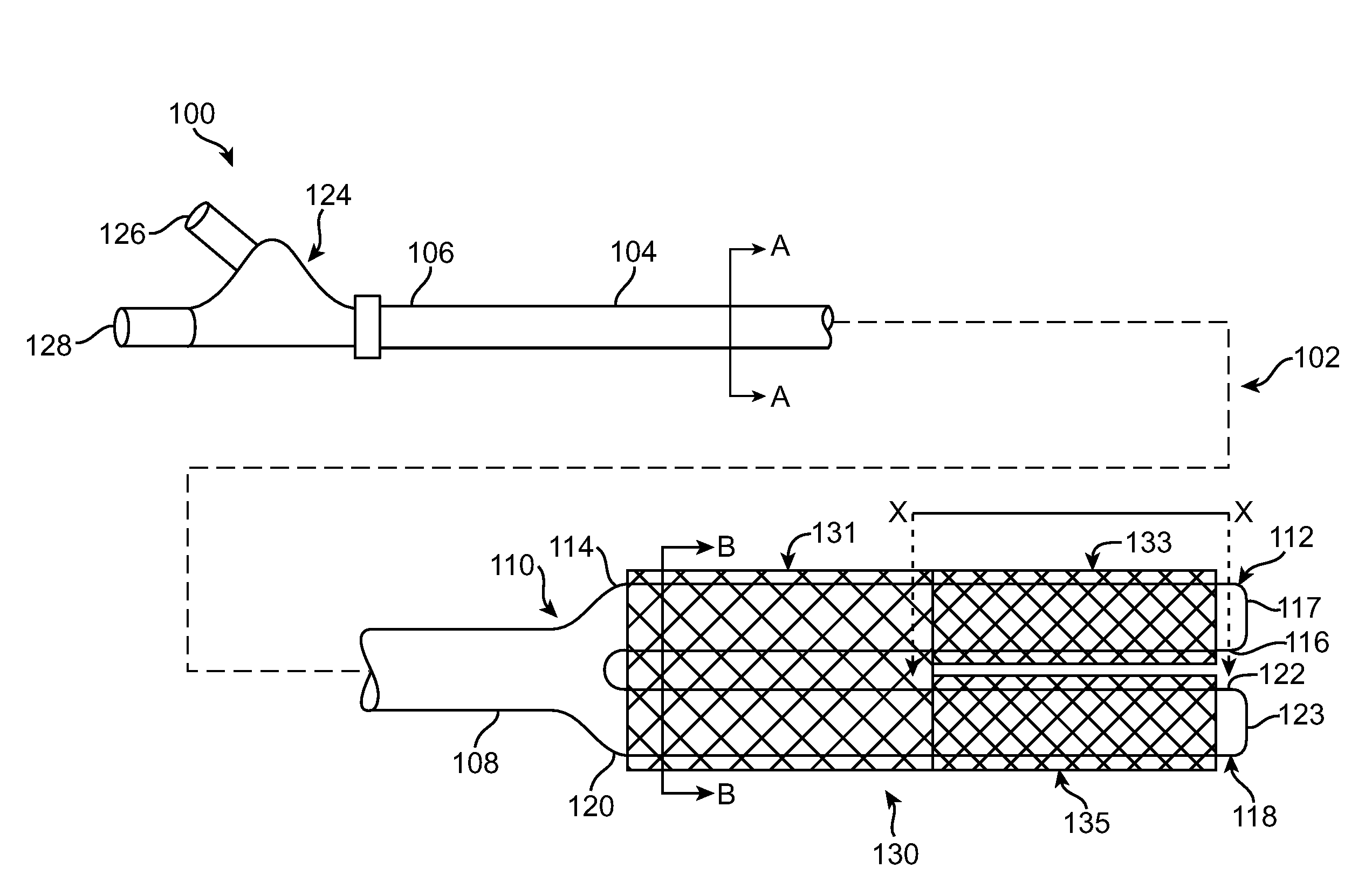 Bifurcate Stent Delivery Catheter