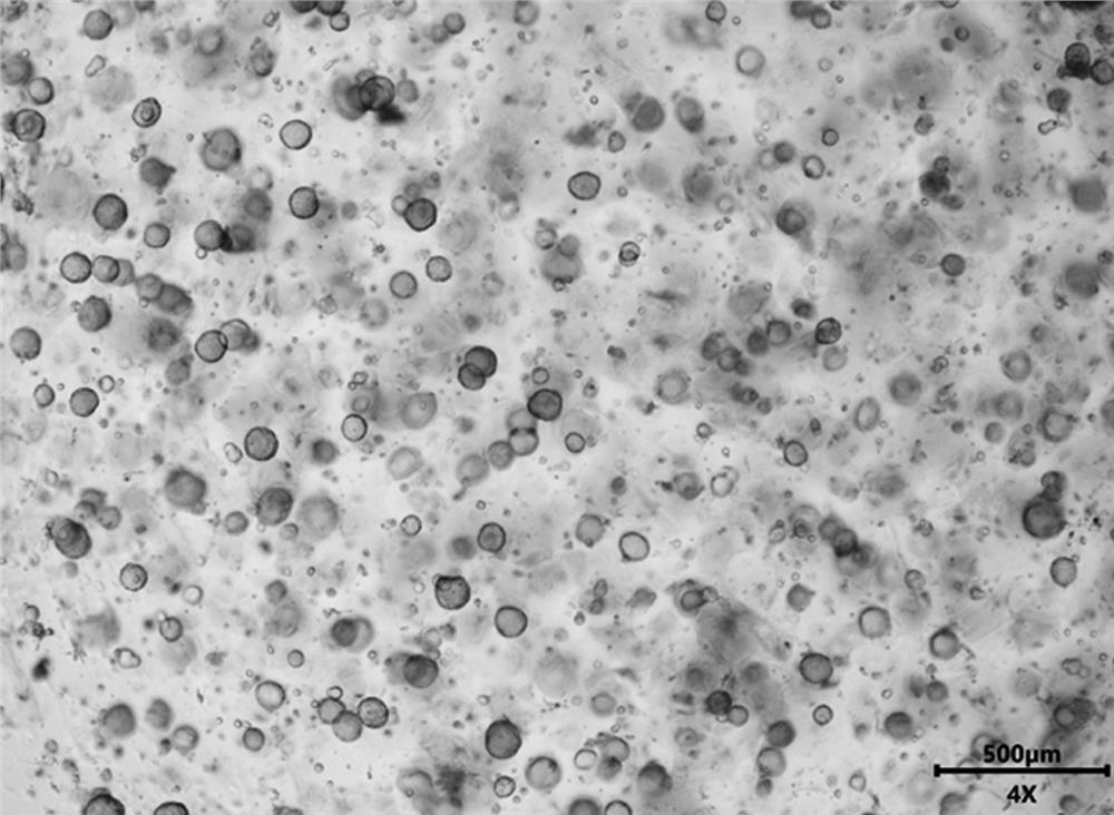 Culture medium and culture method for esophageal cancer tumor organoid culture