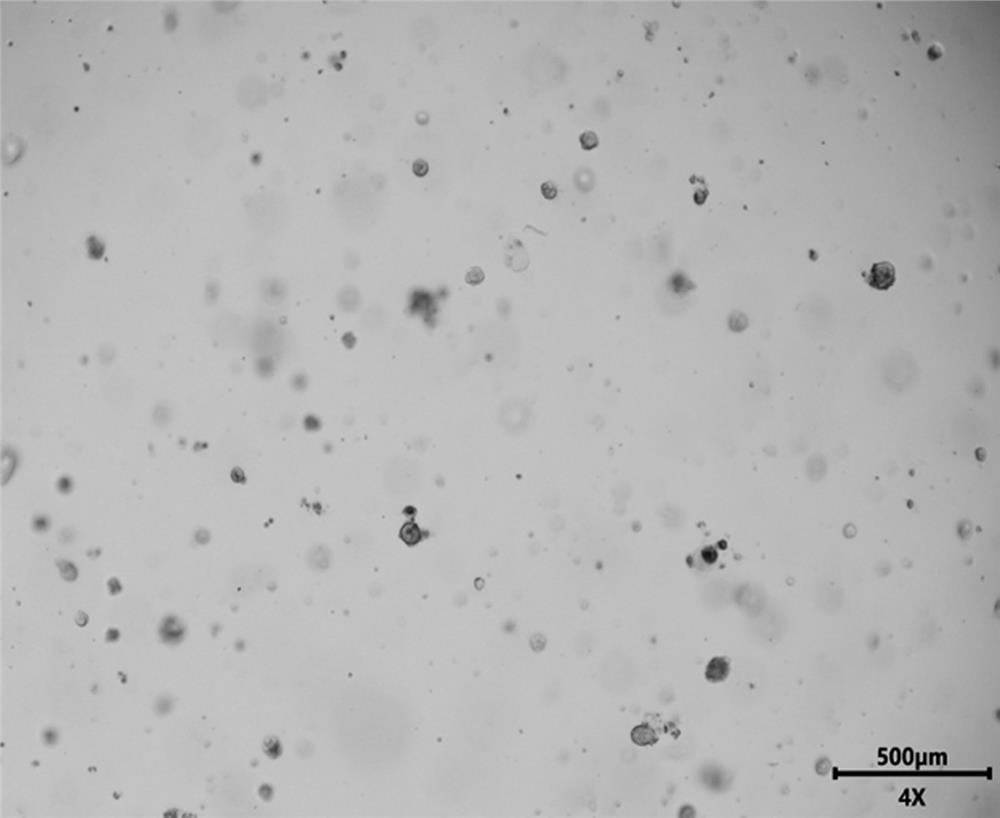 Culture medium and culture method for esophageal cancer tumor organoid culture