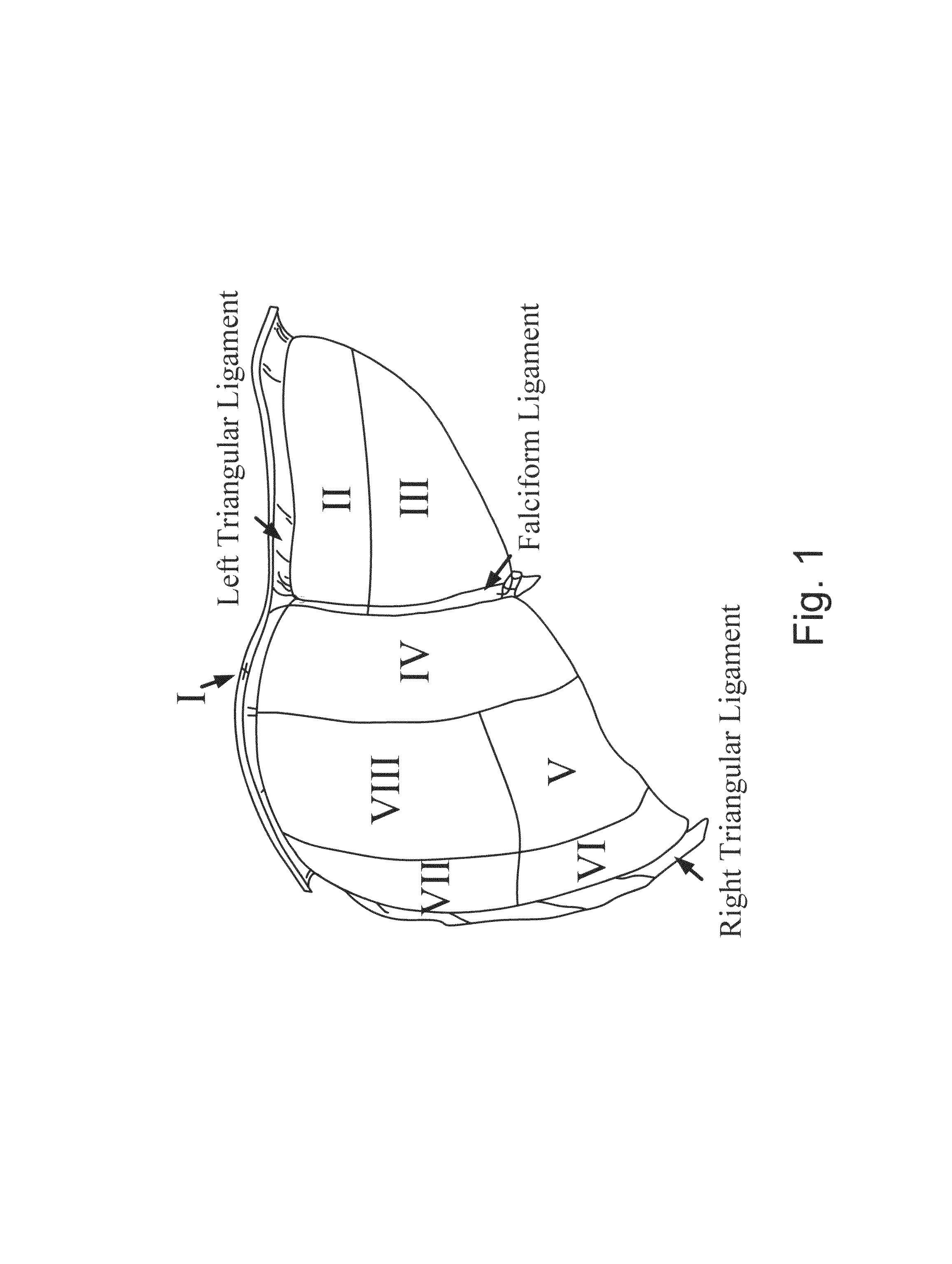 Apparatus and methods of compensating for organ deformation, registration of internal structures to images, and applications of same