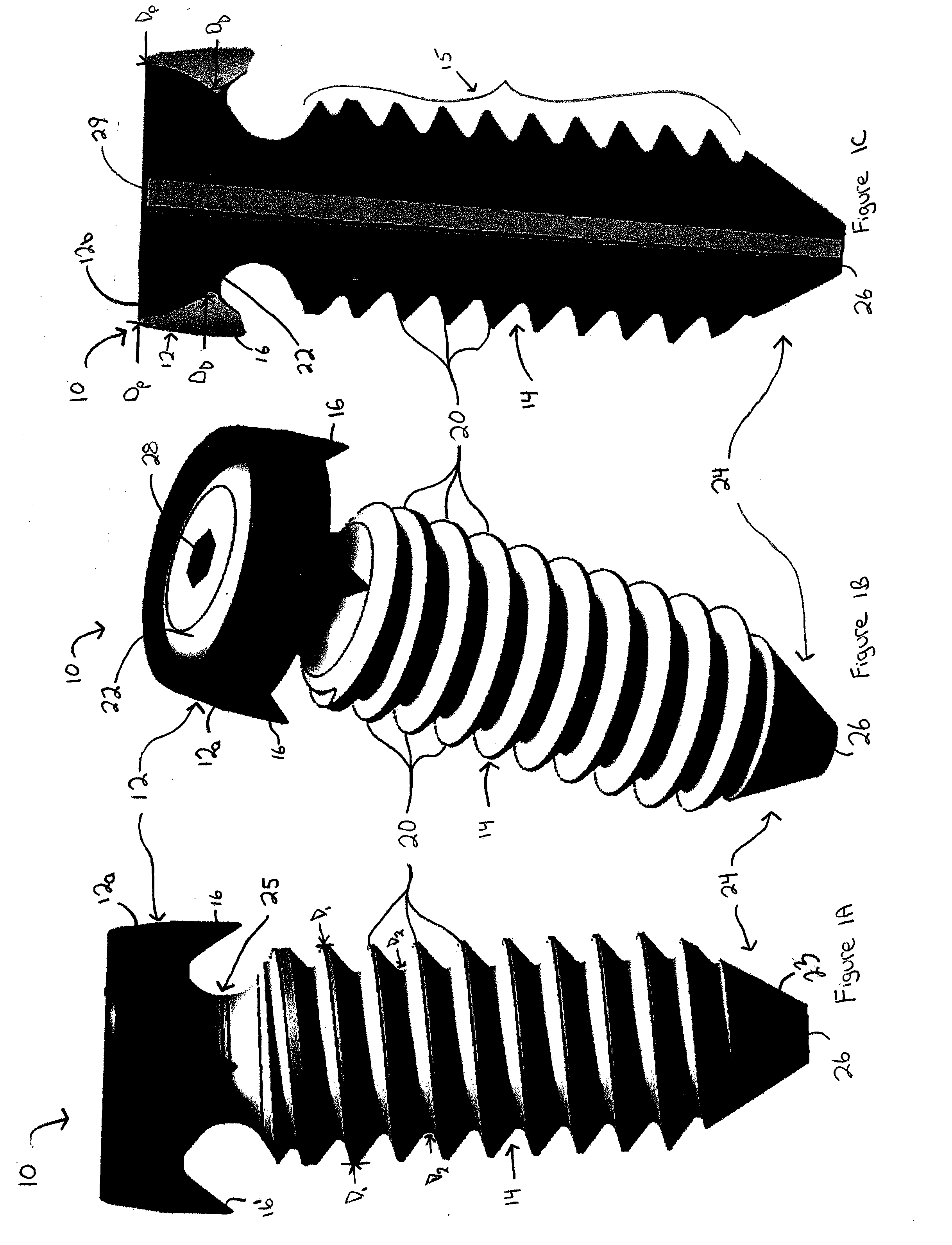 Facet fixation  and fusion screw and washer assembly and method of use