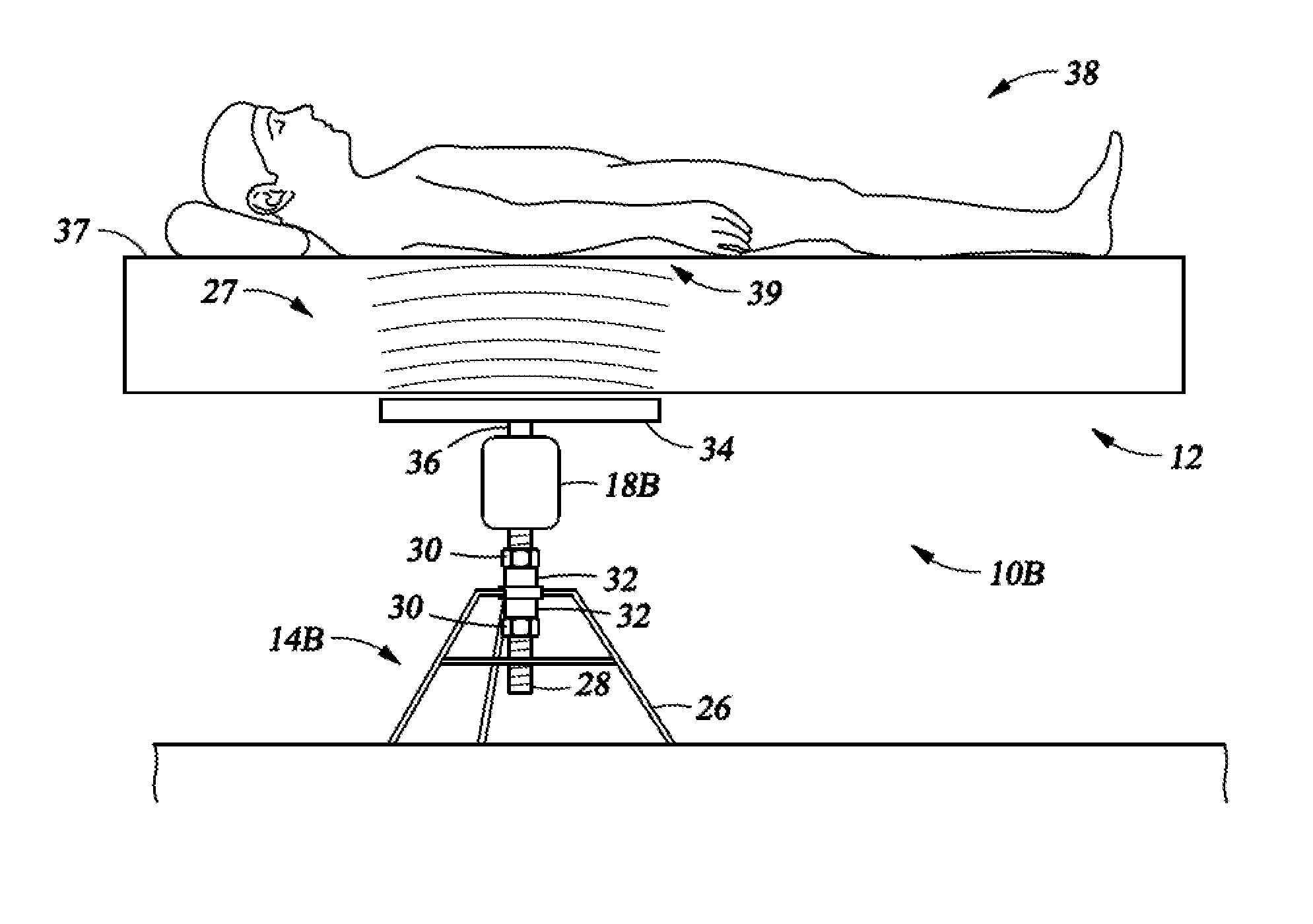 Device and method for treating nocturia