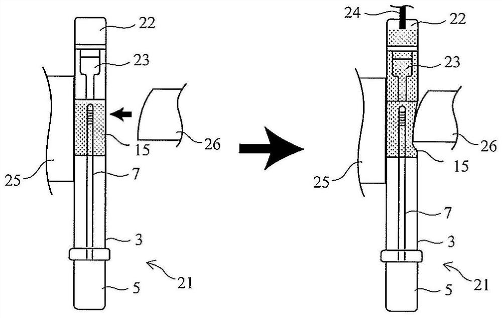 Stool specimen examining device, and stool specimen examining method