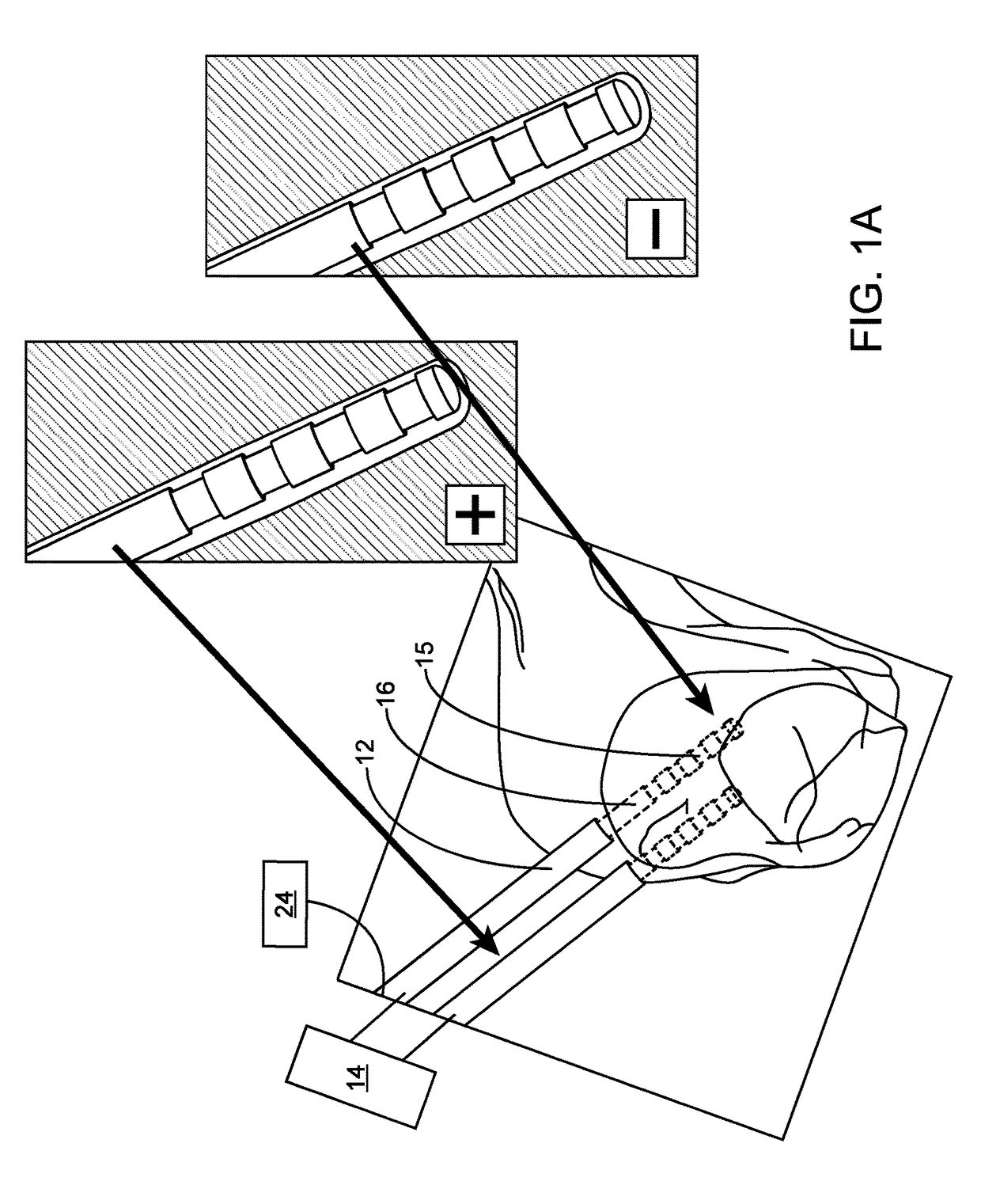 System and methods for multi-site activation of the thalamus