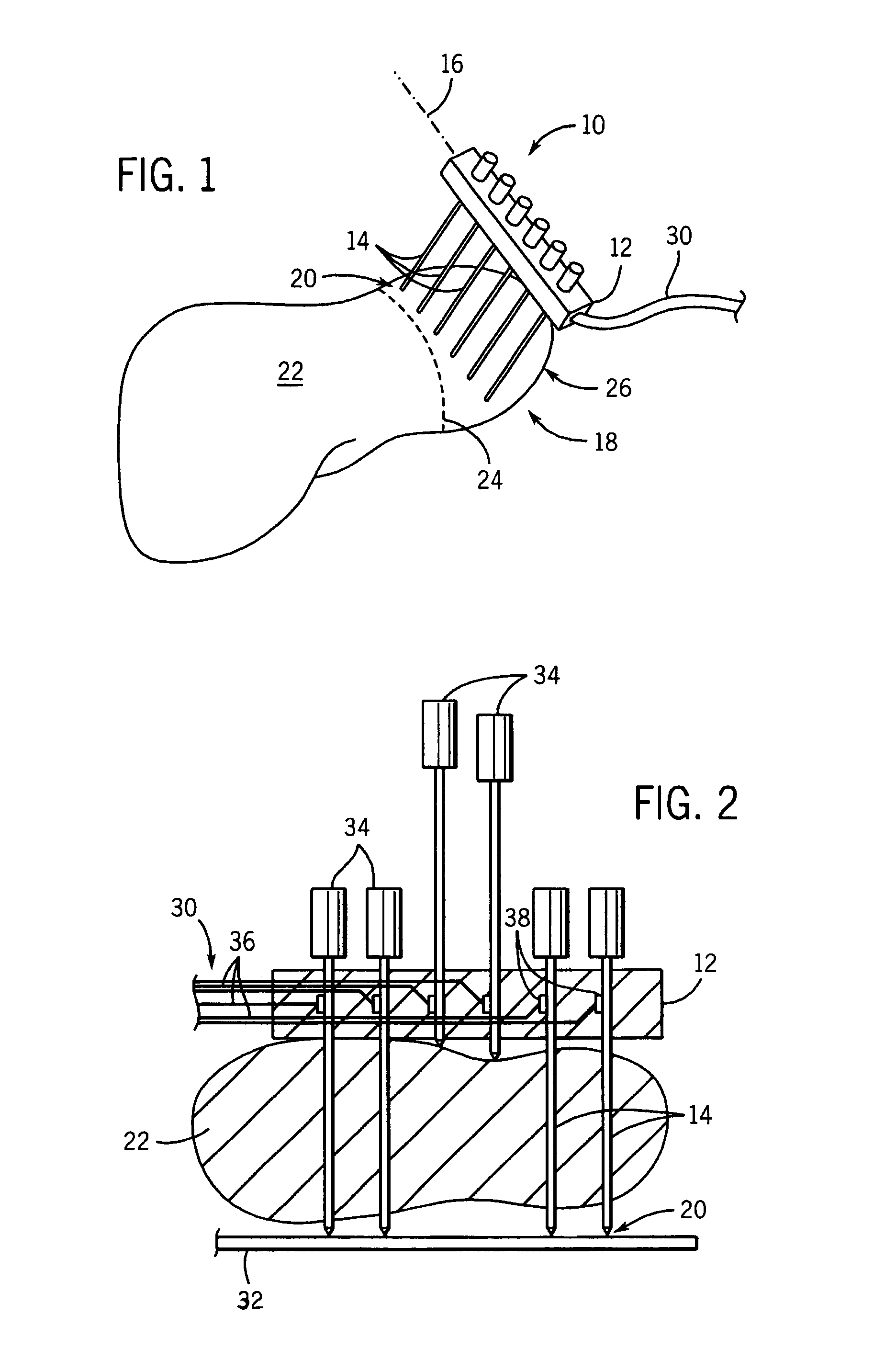 Electrode array for tissue ablation