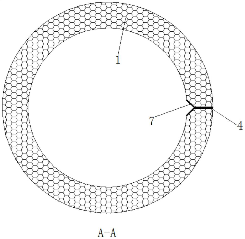 Novel anti-backflow ureteral stent