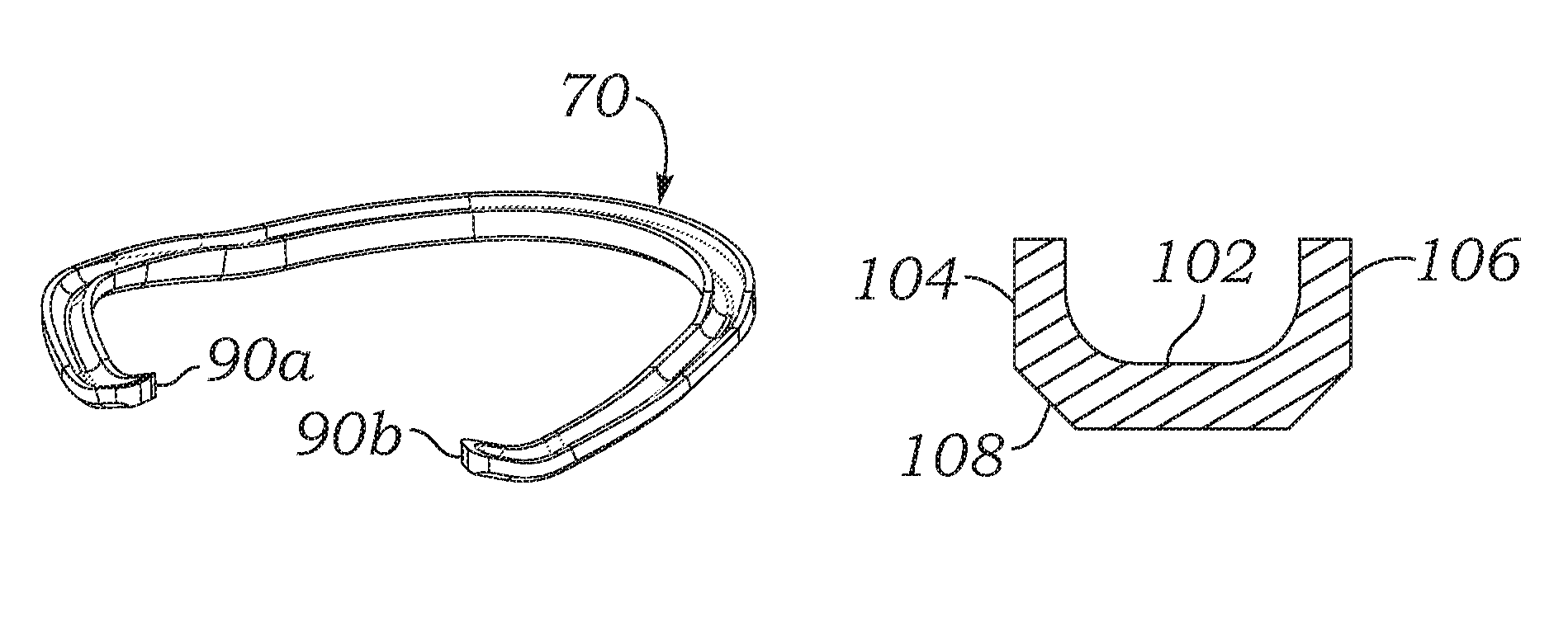 Physiologic tricuspid annuloplasty ring