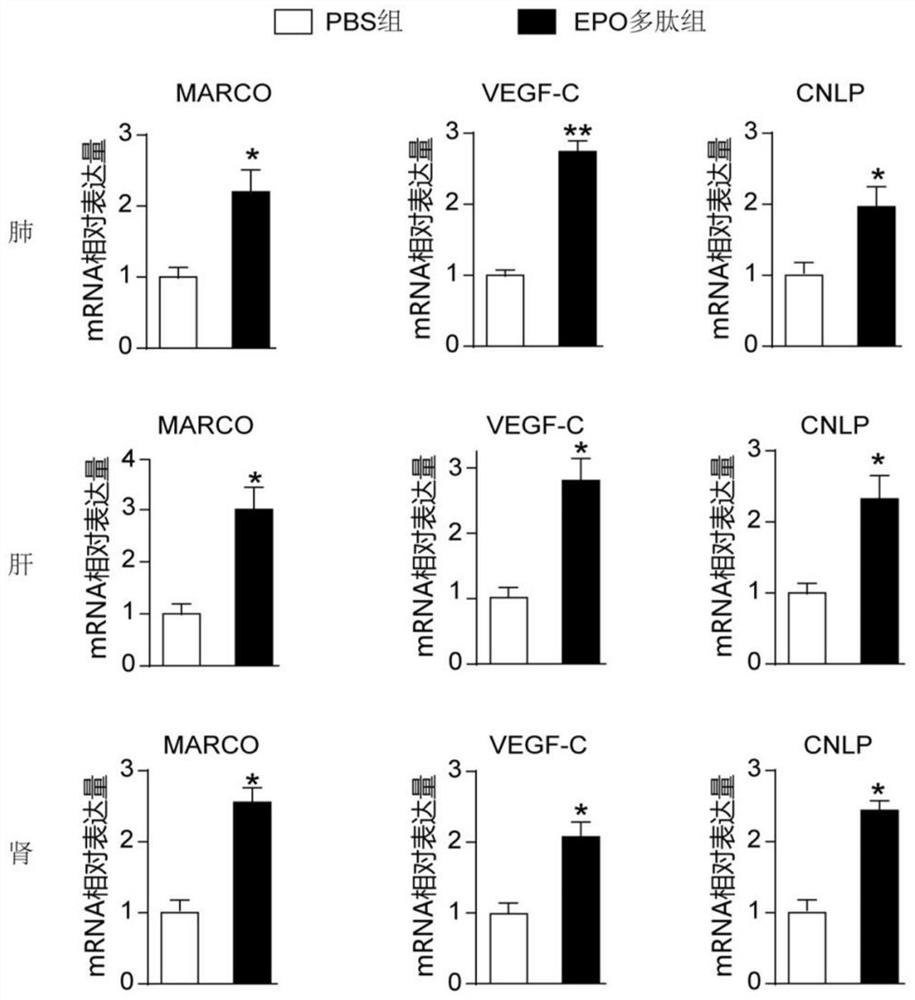 Application of EPO (erythropoietin) analogue in preparation of medicine for treating sepsis