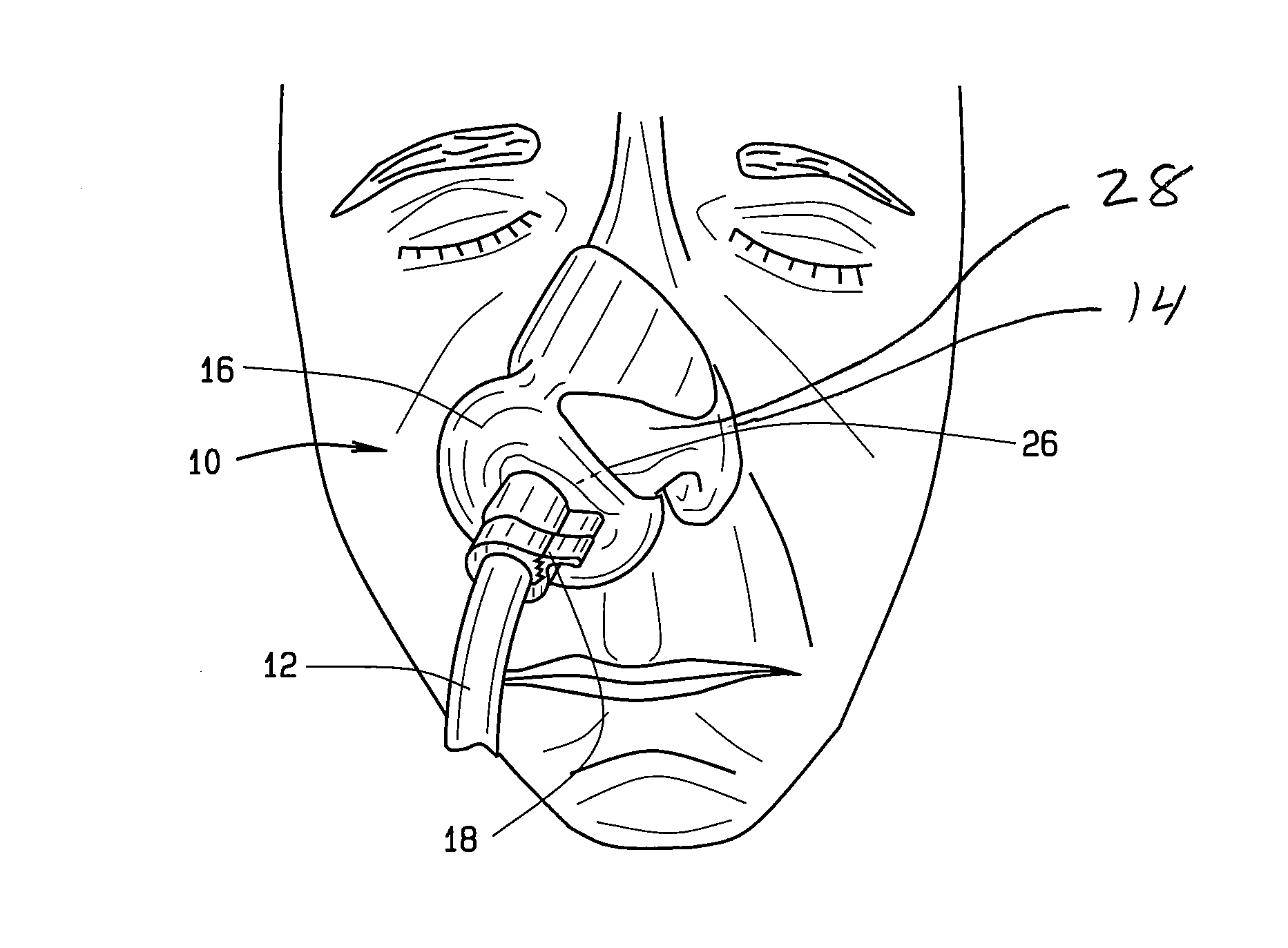 Nasal device and method of positioning nasogastric tubing within a patient