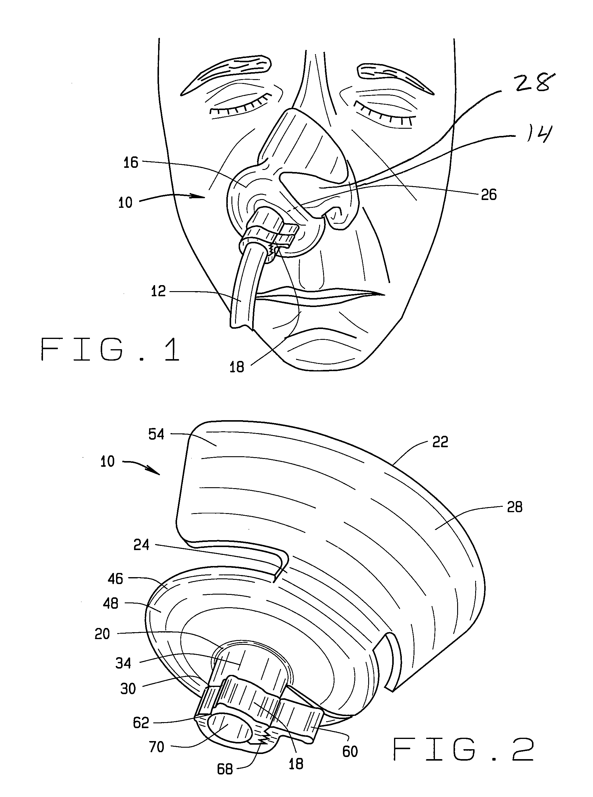 Nasal device and method of positioning nasogastric tubing within a patient