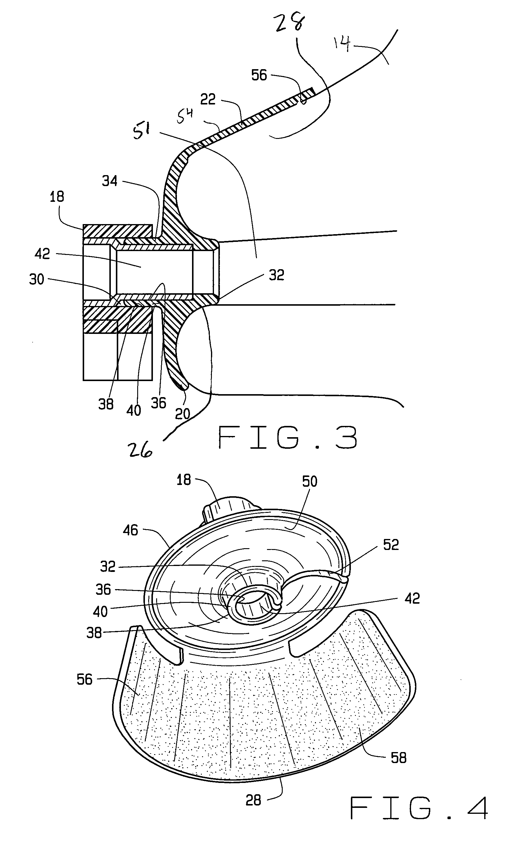 Nasal device and method of positioning nasogastric tubing within a patient