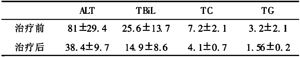 Pharmaceutical composition for invigorating liver and eliminating lipid as well as preparation method, preparation and application thereof