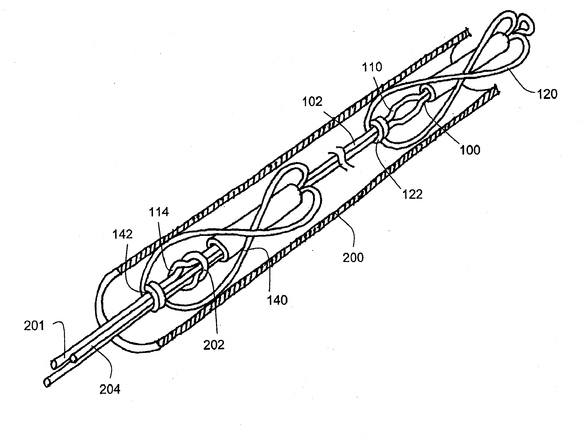 Tissue Shaping Device with Integral Connector and Crimp