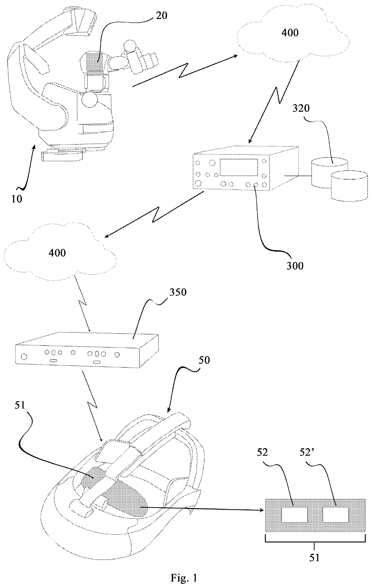 Immersive display system for eye therapies