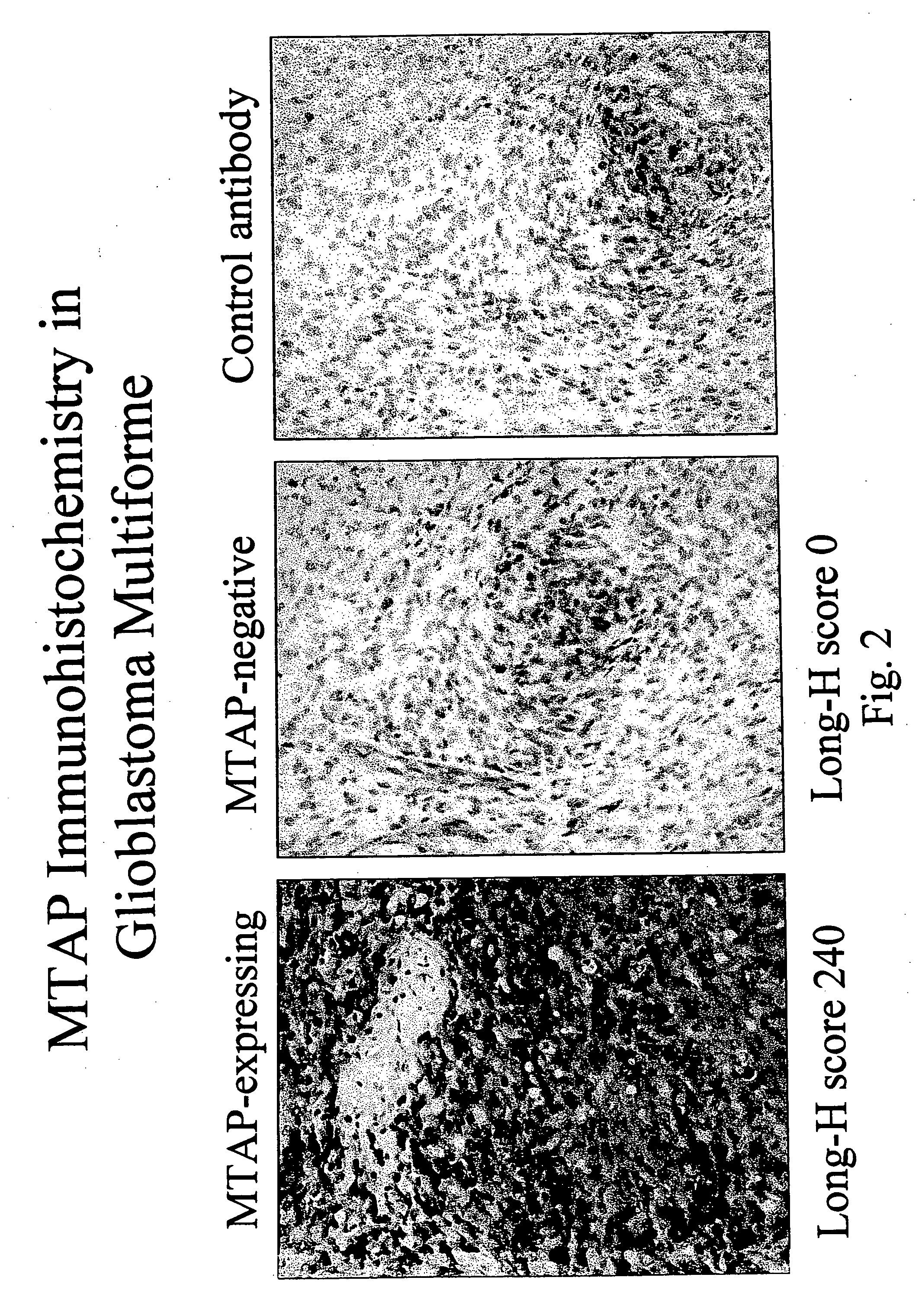 Compositions and methods for the detection and treatment of methylthioadenosine phosphorylase deficient cancers