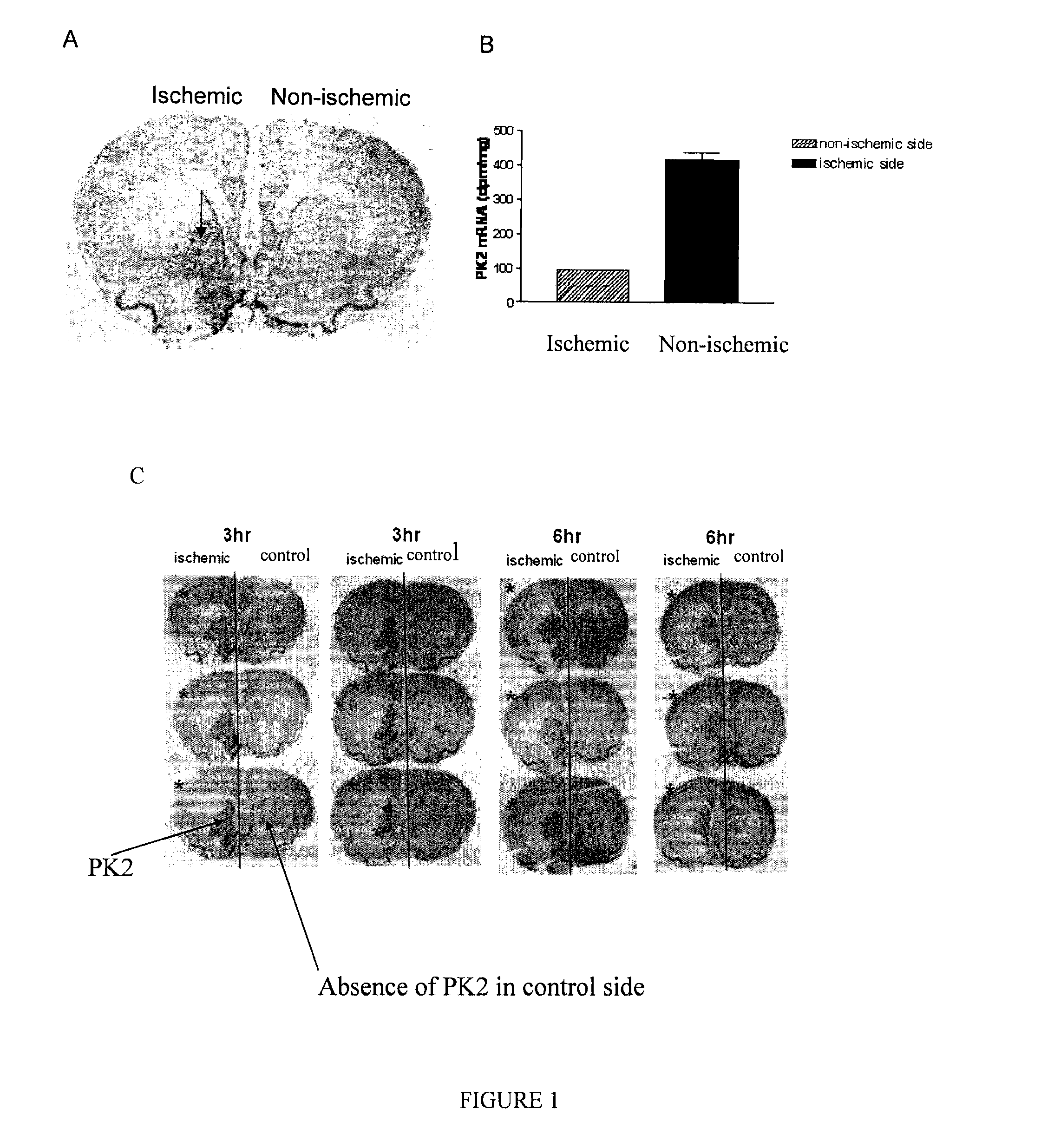 Methods for treating cerebrovascular disease comprising administering an agent that inhibits prokineticin receptor activity