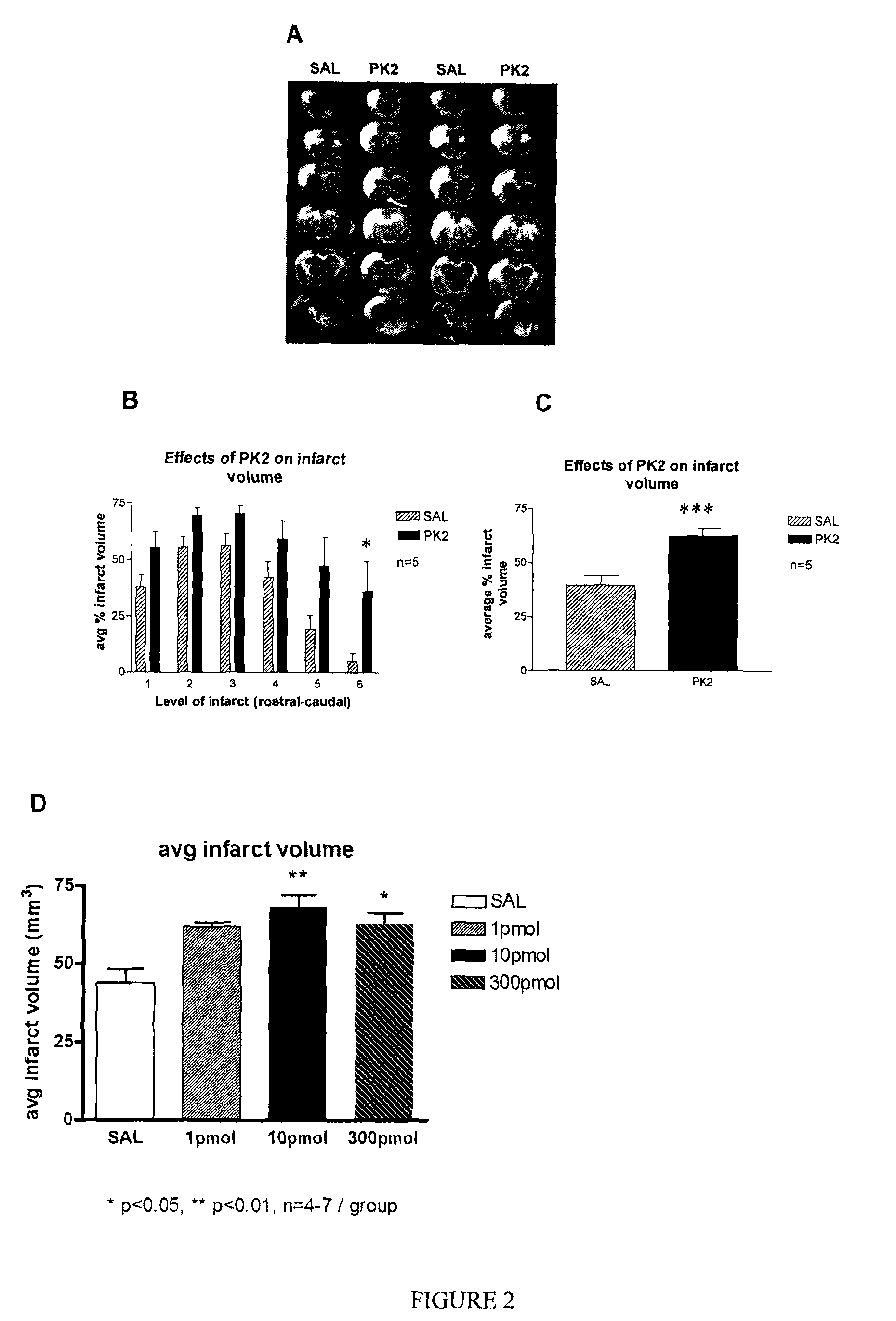 Methods for treating cerebrovascular disease comprising administering an agent that inhibits prokineticin receptor activity