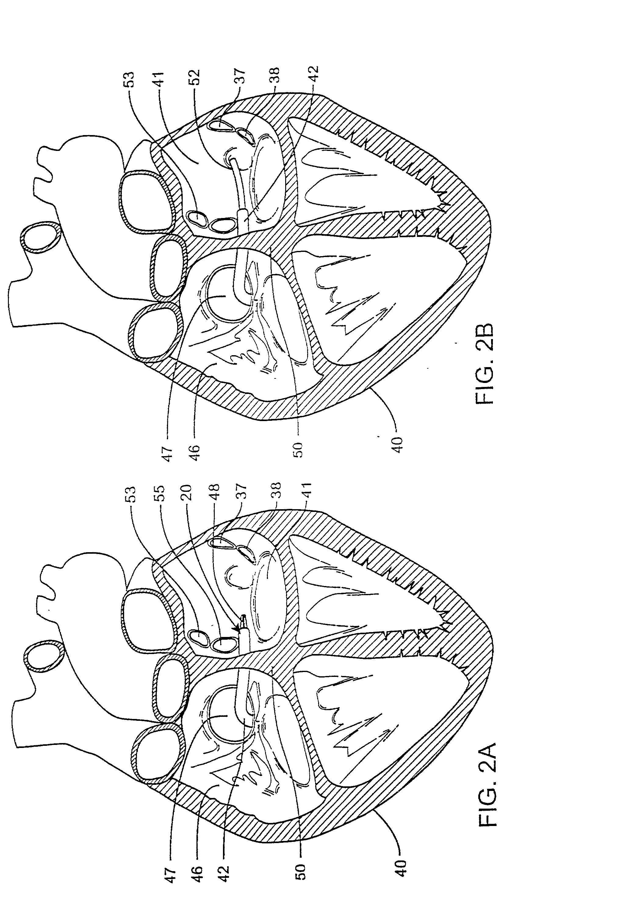 Medical instrument positioning tool and method