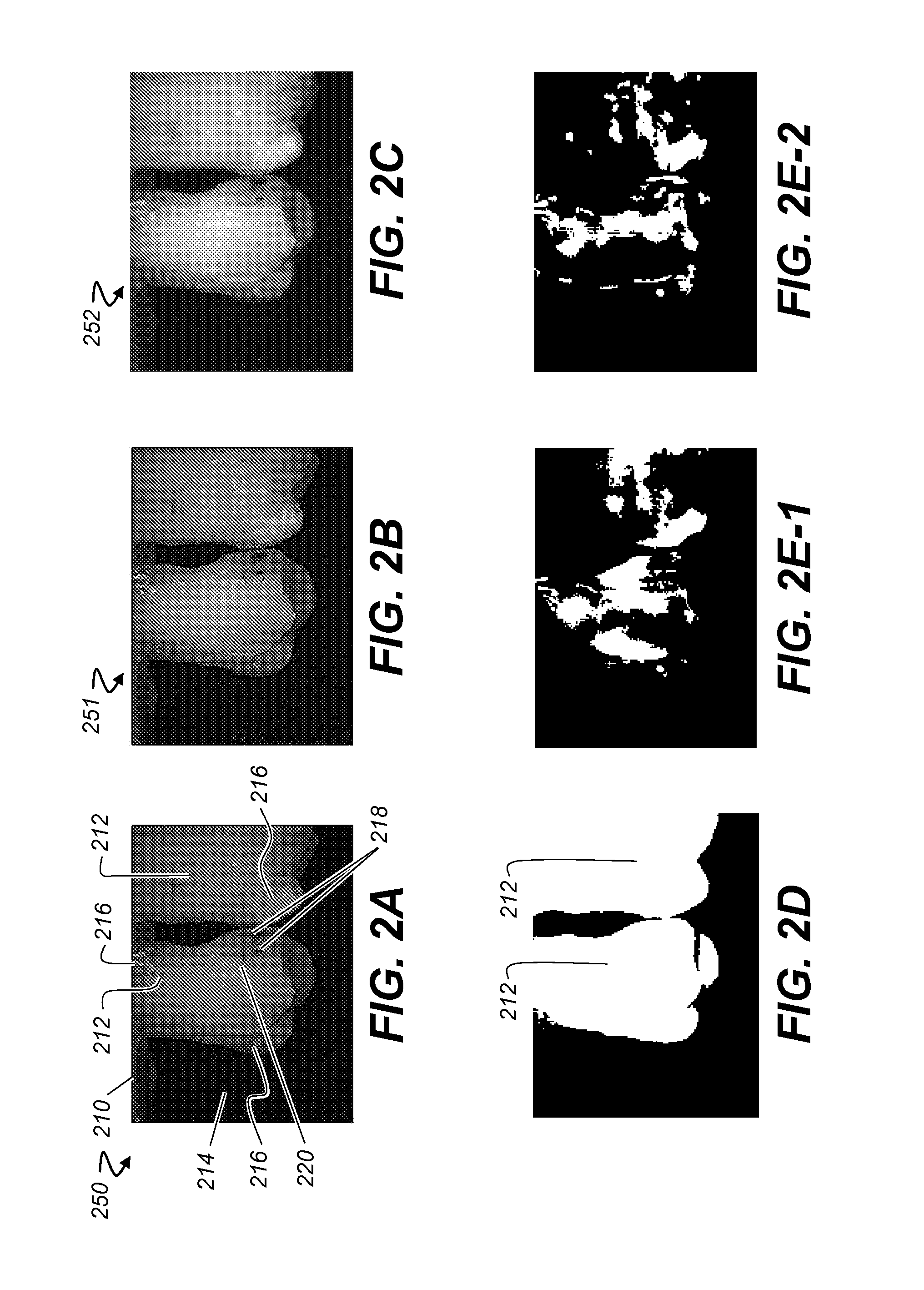 Method for identification of dental caries in polychromatic images